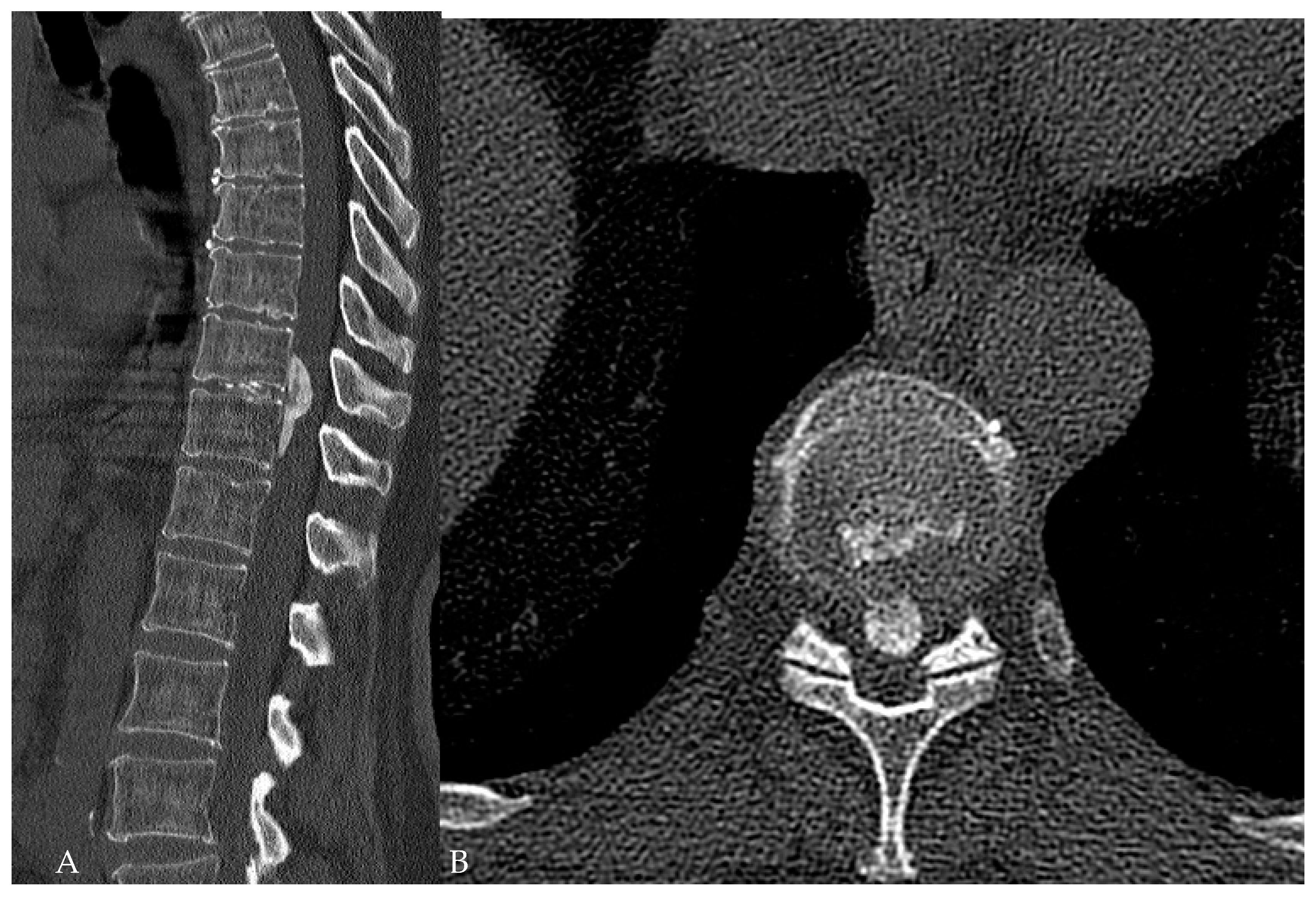 Medicina 60 00887 g010