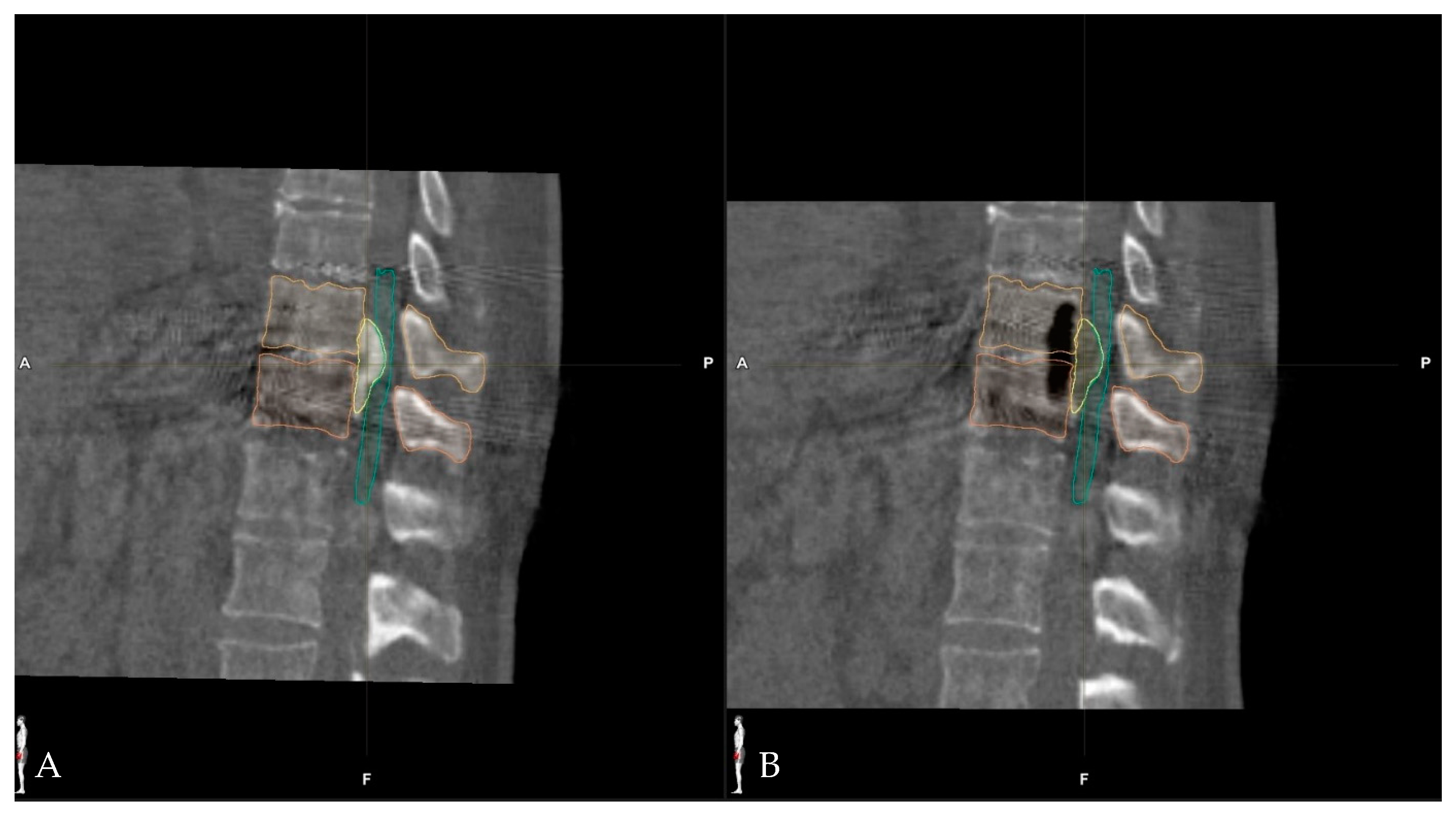 Medicina 60 00887 g012