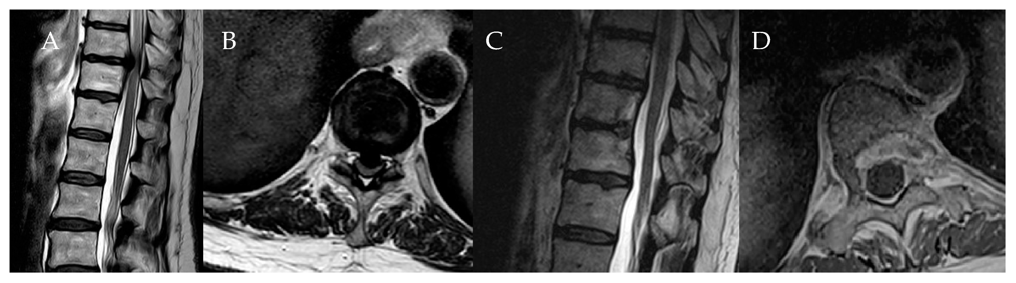 Medicina 60 00887 g013