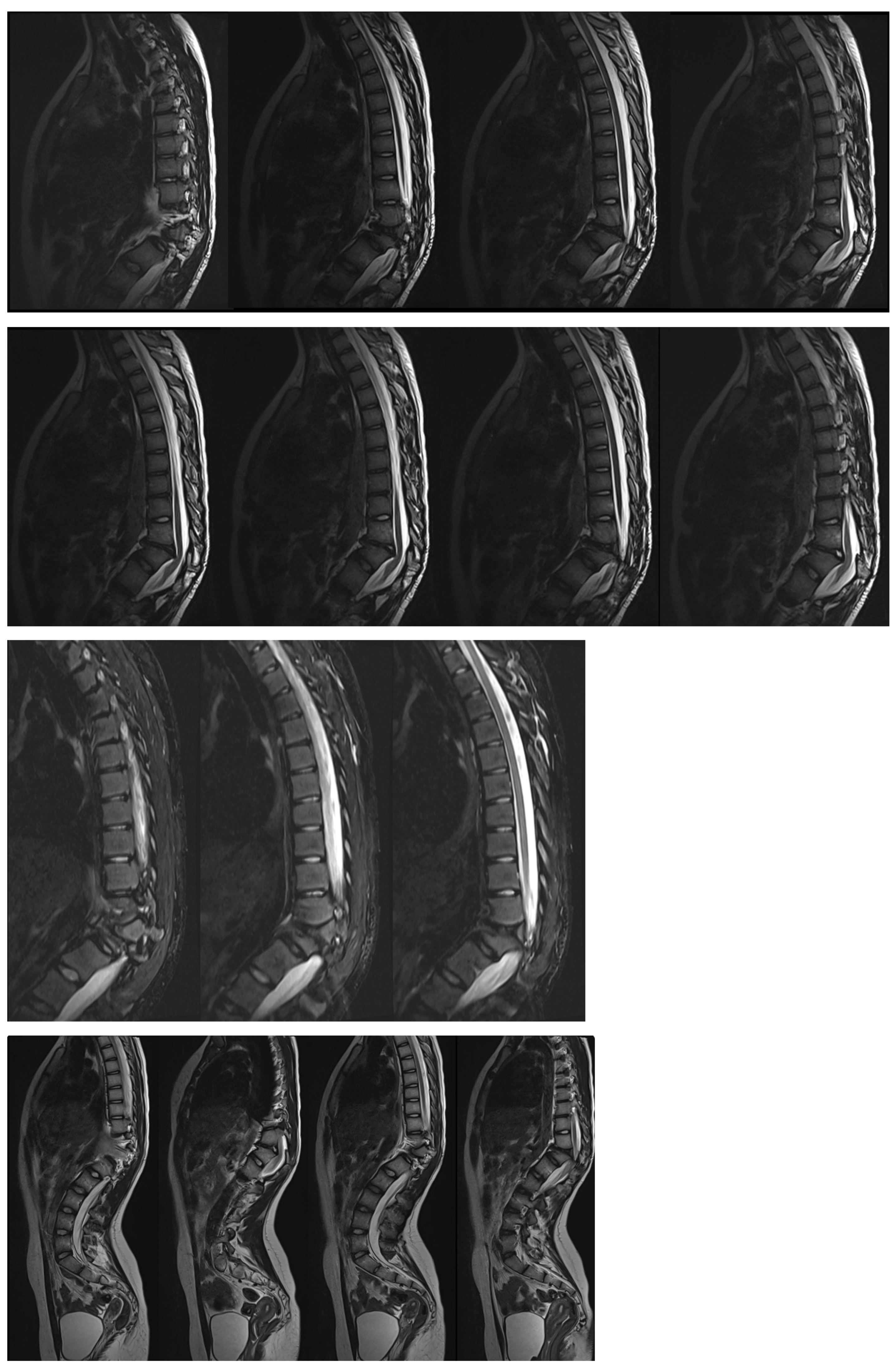 Medicina 60 00897 g003