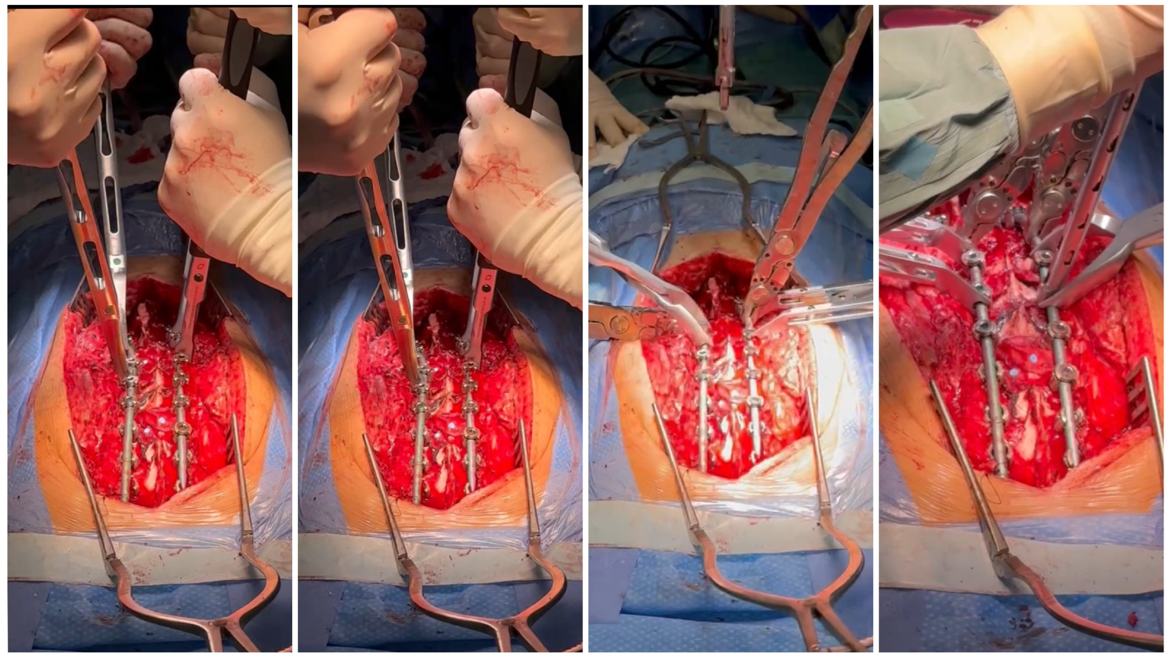 Medicina 60 00897 g006