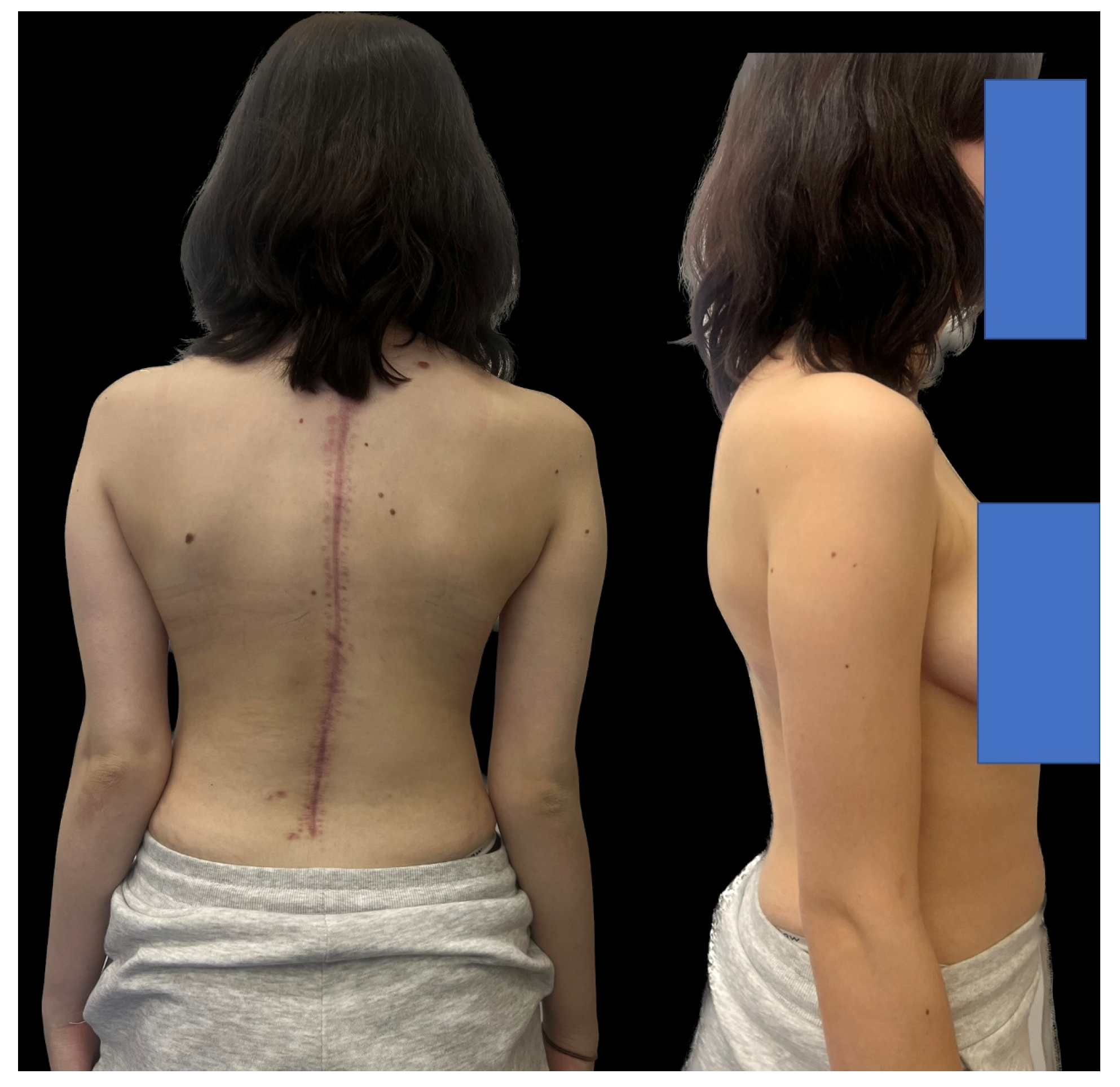 Medicina 60 00897 g009