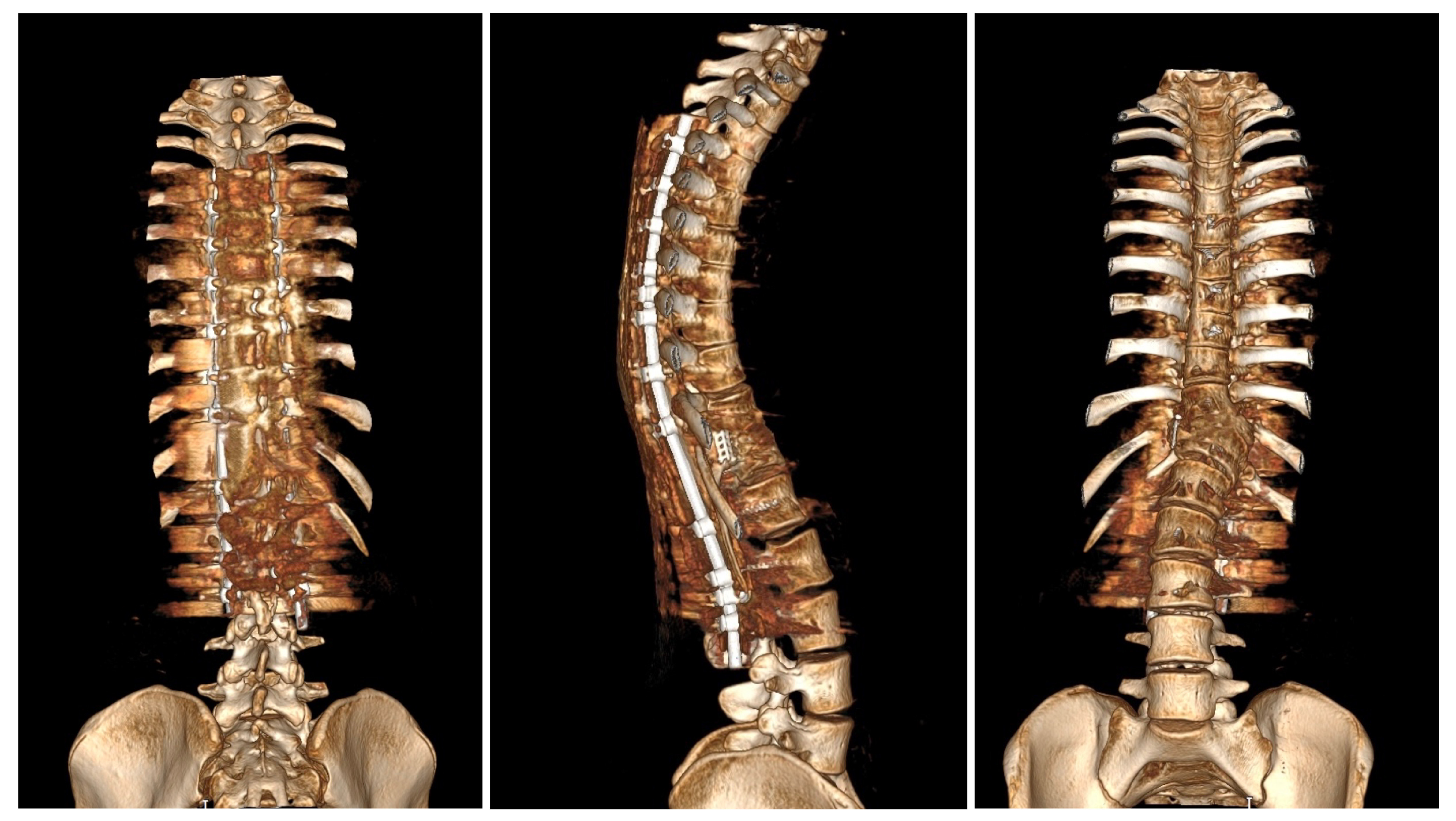 Medicina 60 00897 g011