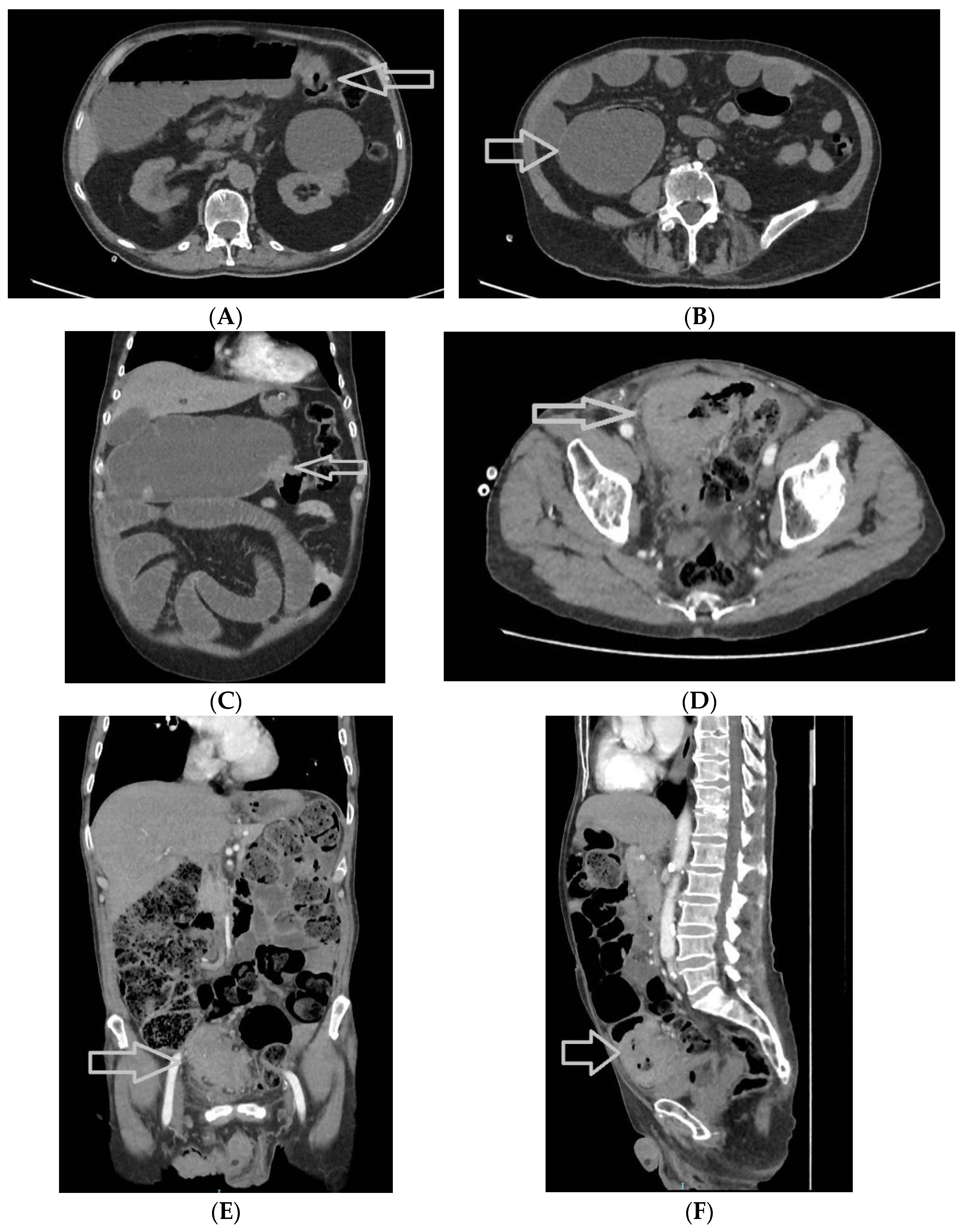 Medicina 60 00898 g004a