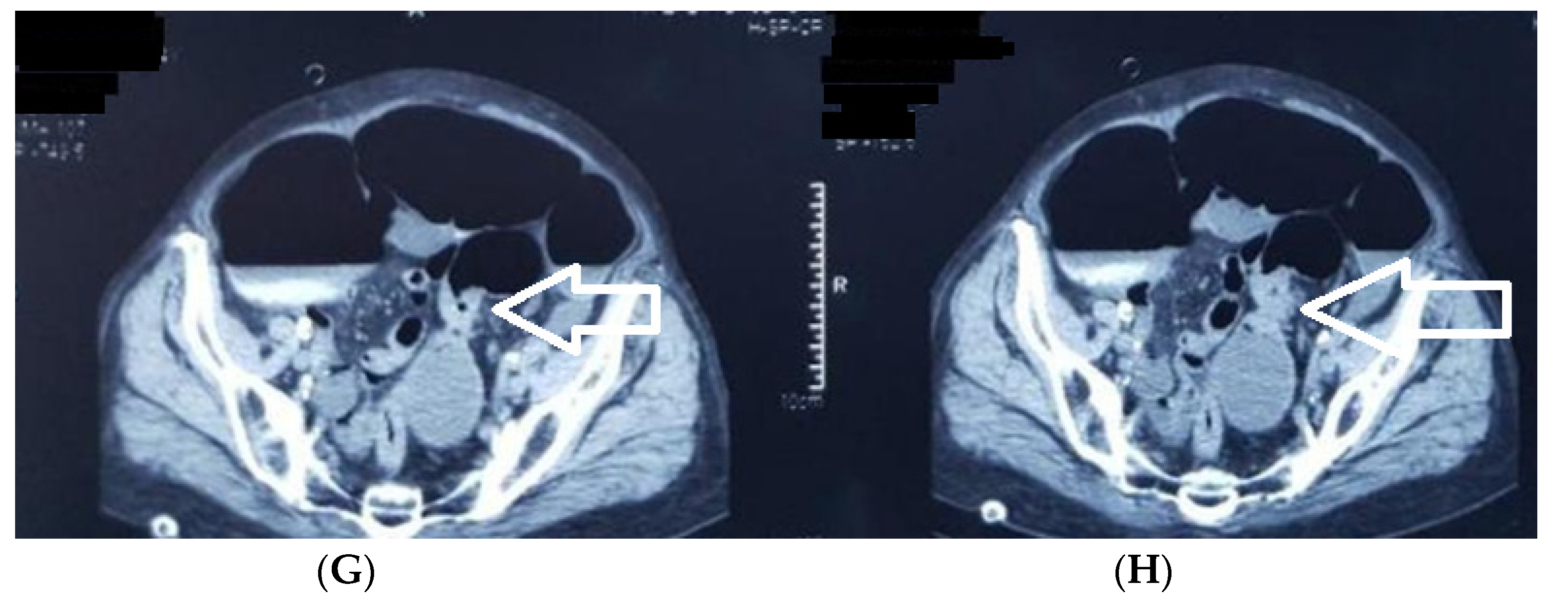 Medicina 60 00898 g004b