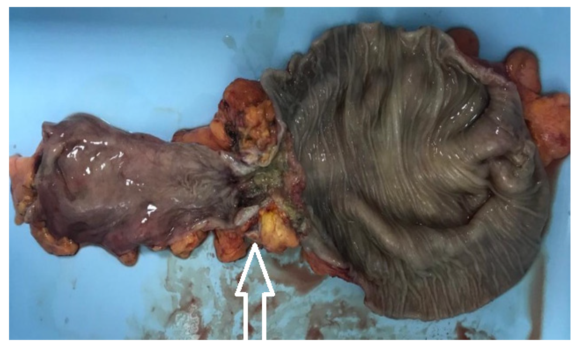 Medicina 60 00898 g009