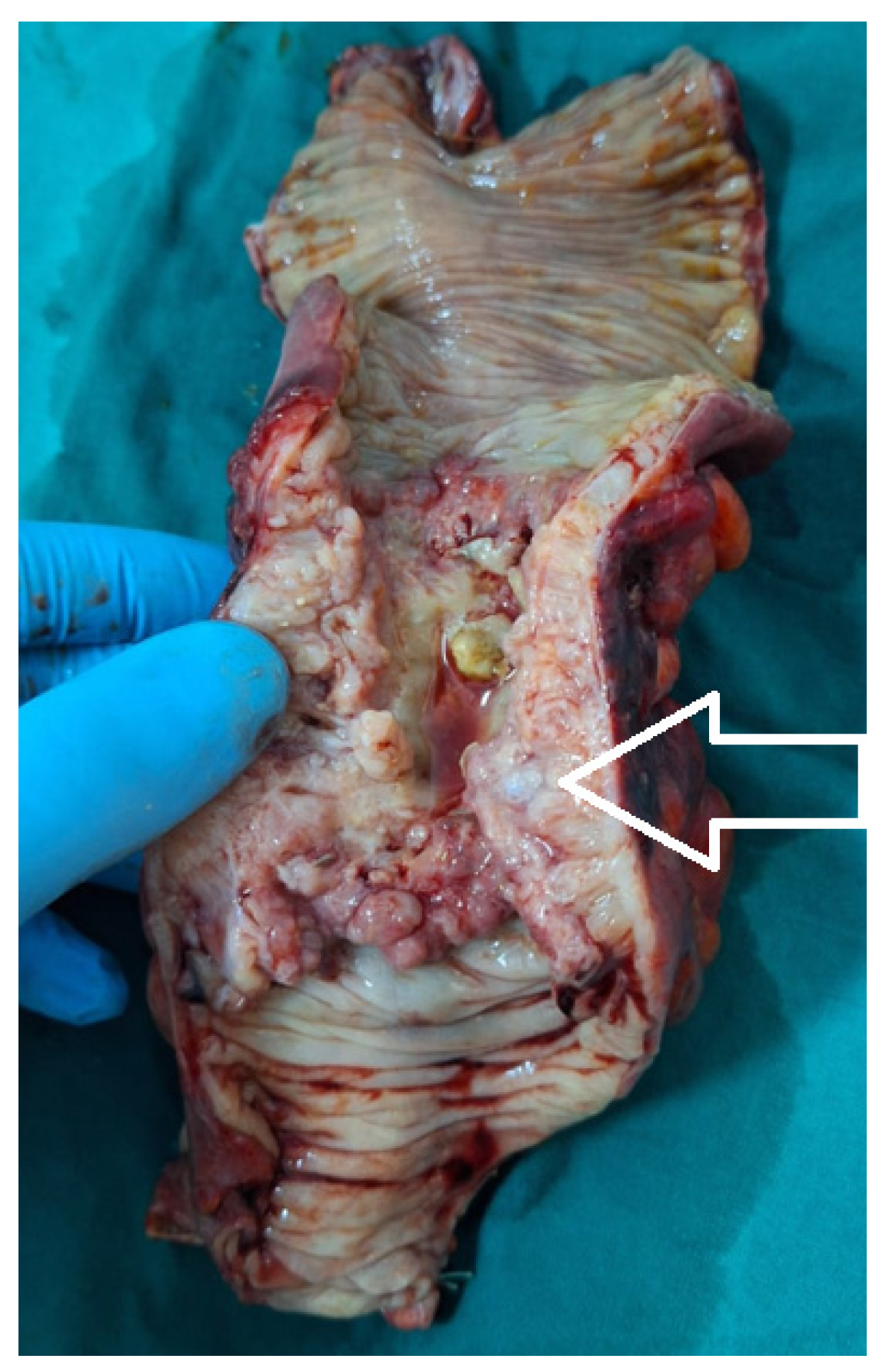 Medicina 60 00898 g010