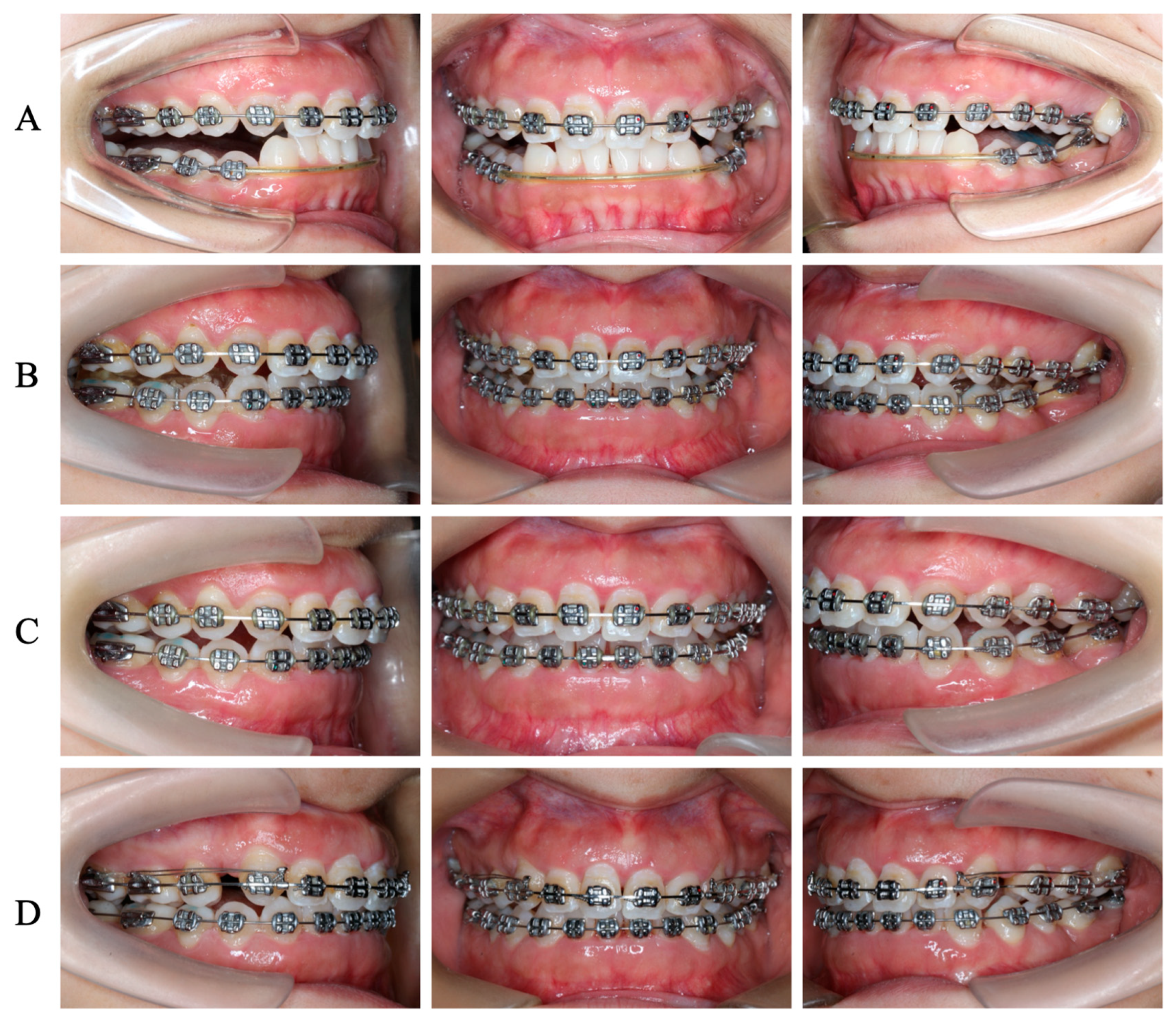 Medicina 60 00904 g004