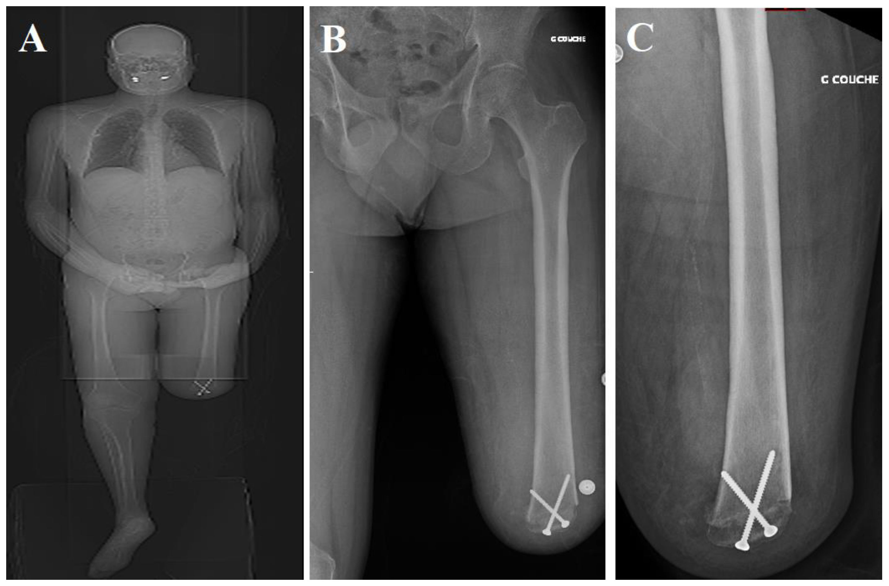 Medicina 60 00911 g001