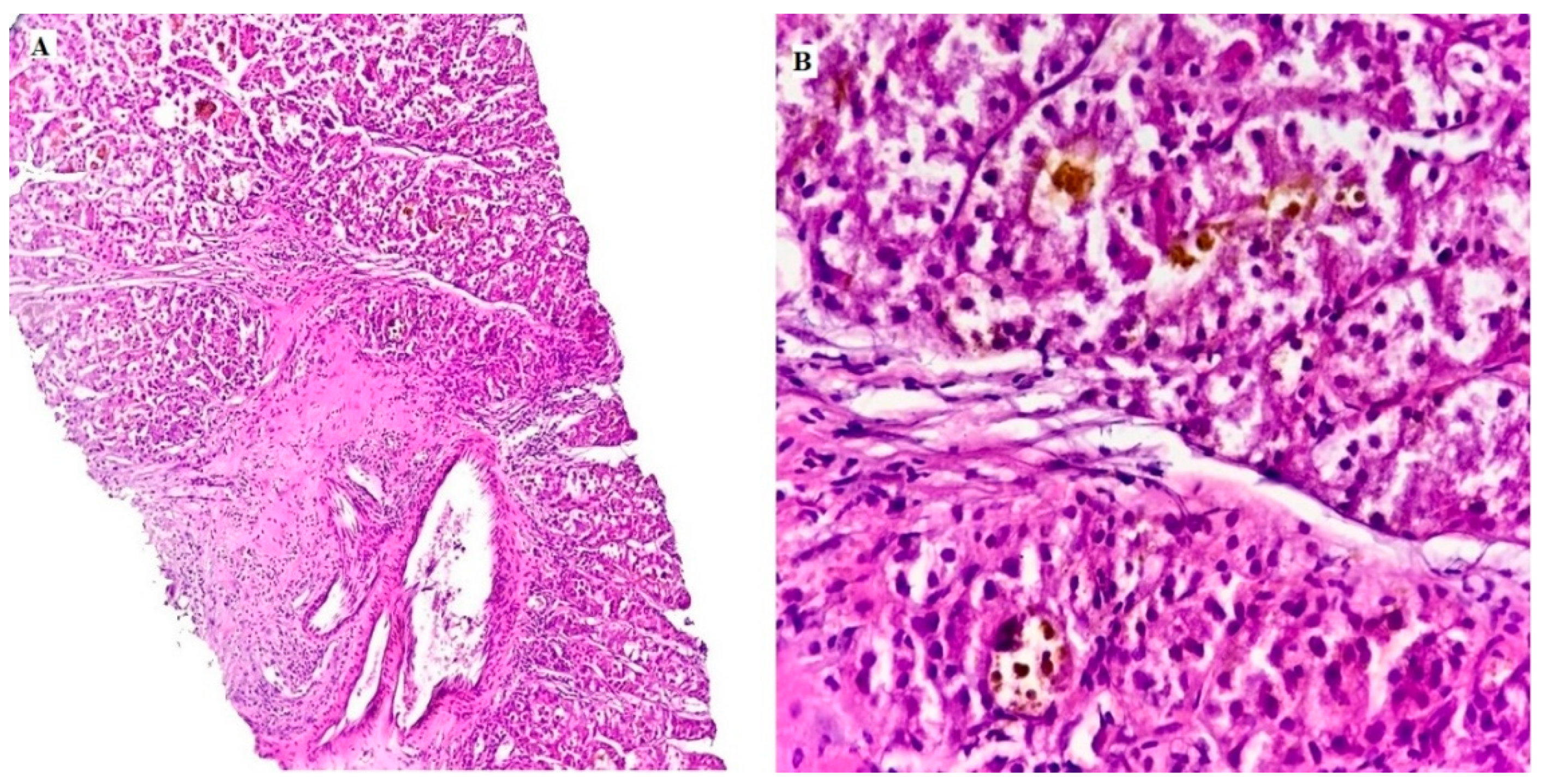 Medicina 60 00915 g001