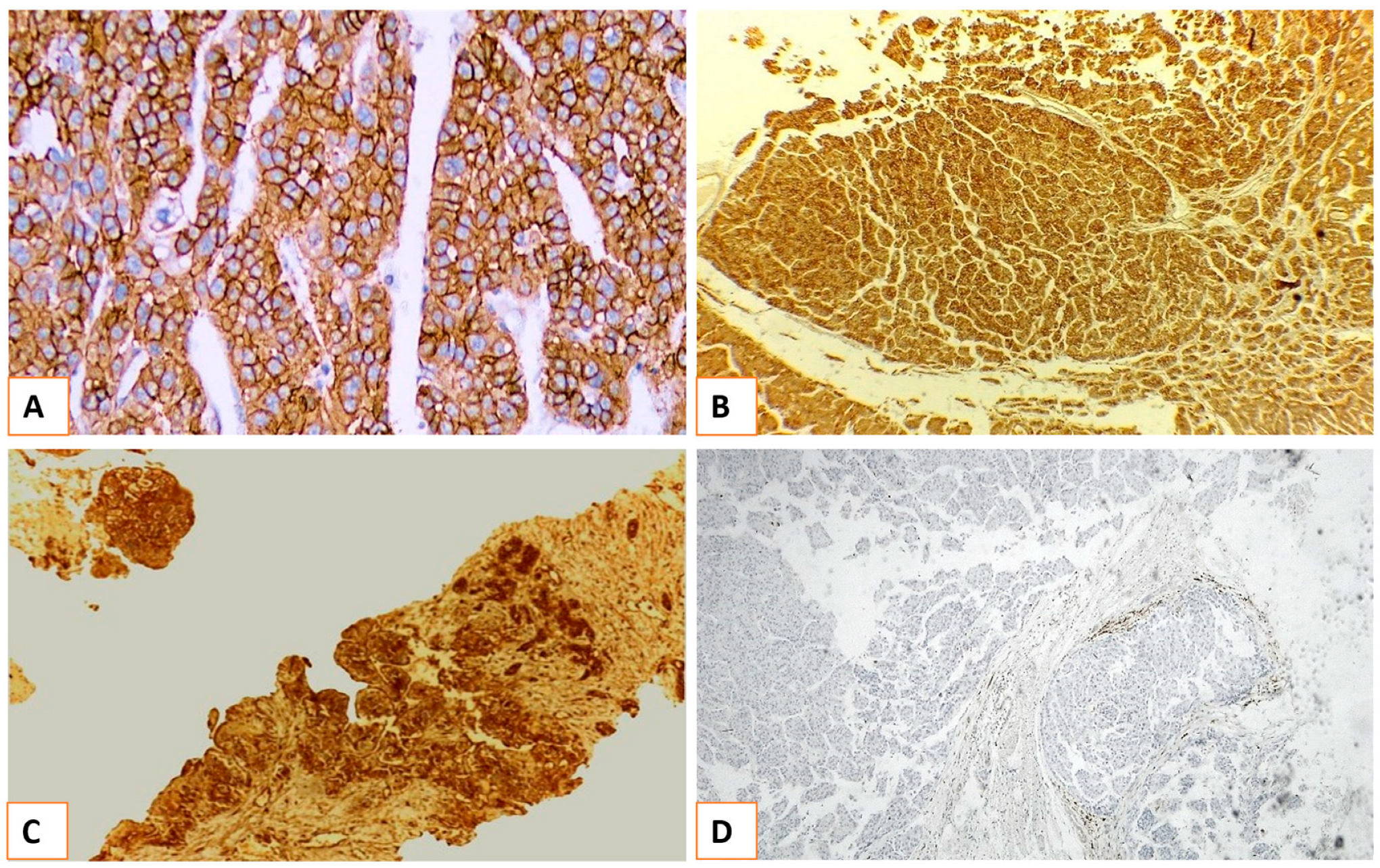 Medicina 60 00915 g002