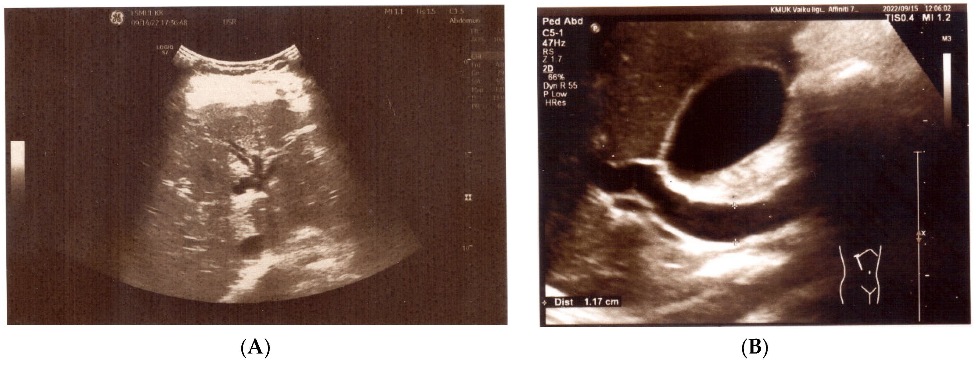 Medicina 60 00916 g001