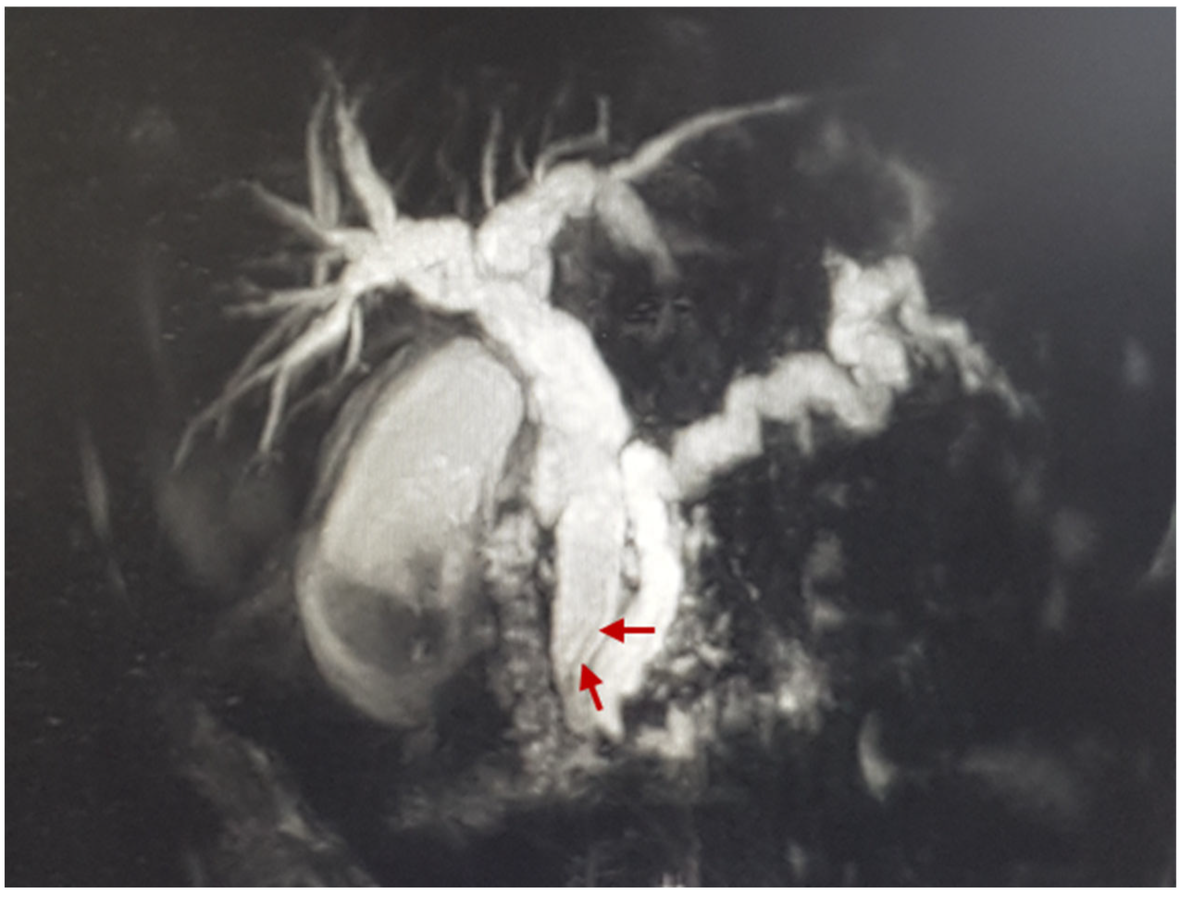 Medicina 60 00916 g002