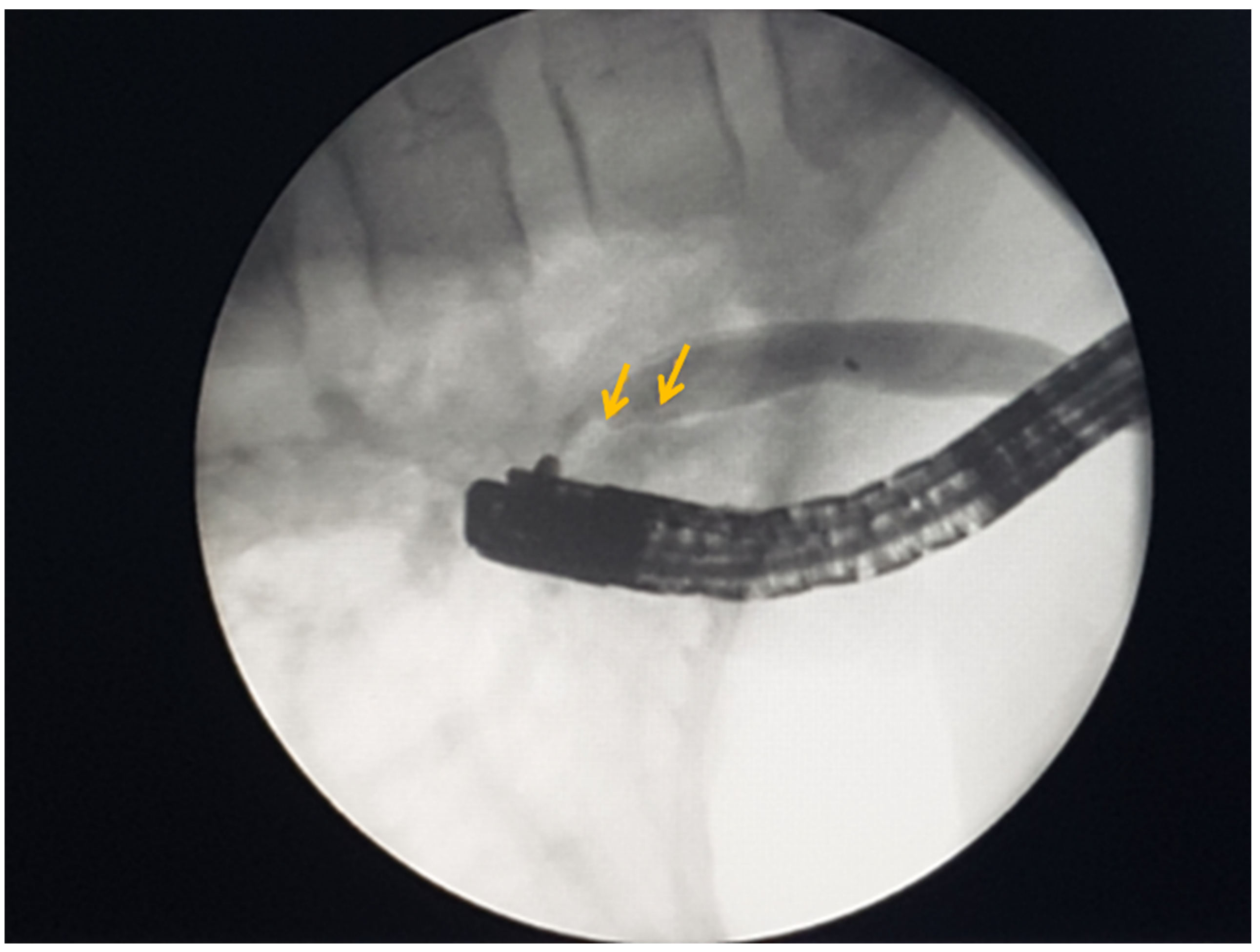 Medicina 60 00916 g003