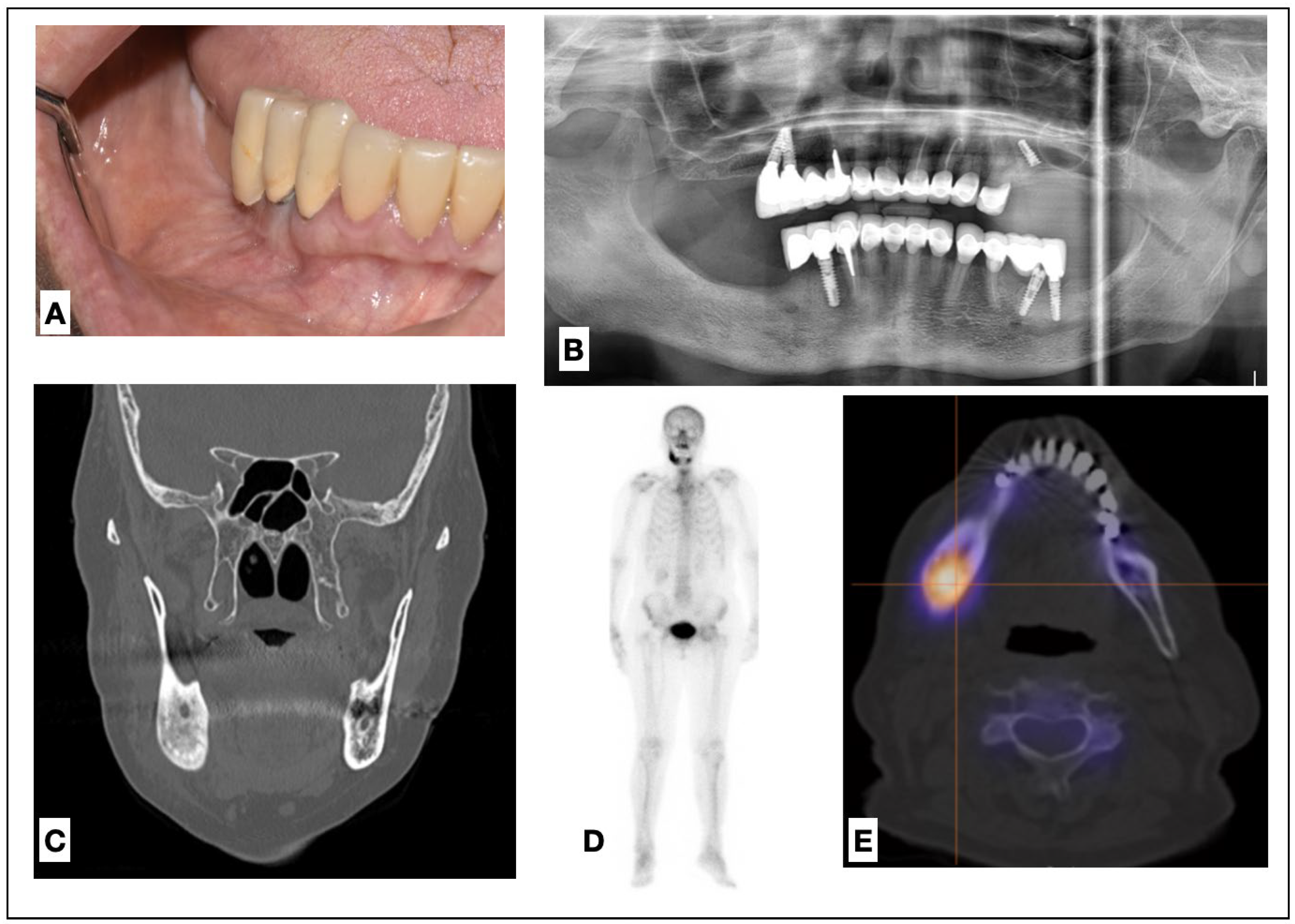 Medicina 60 00917 g002