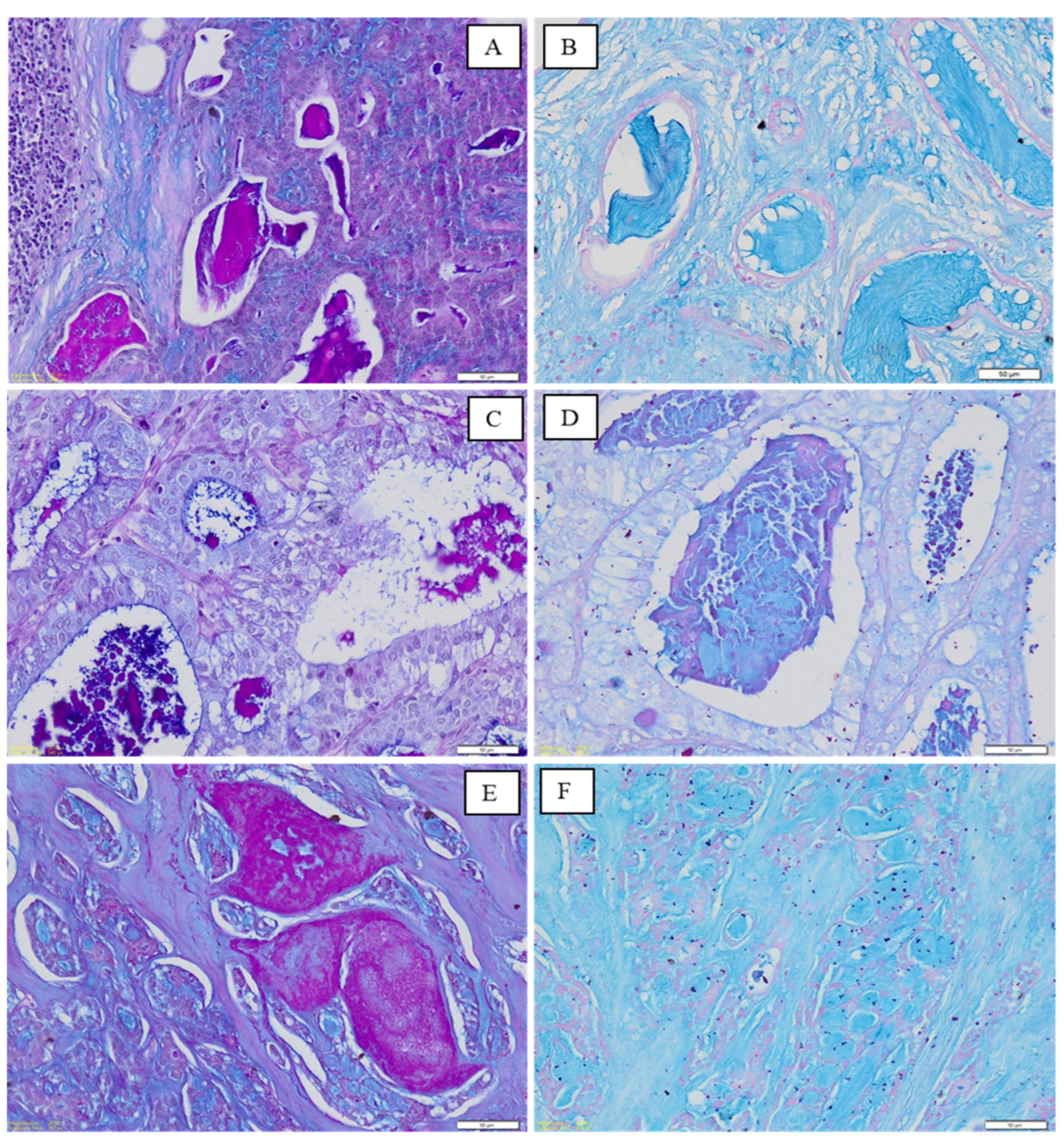 Medicina 60 00920 g002