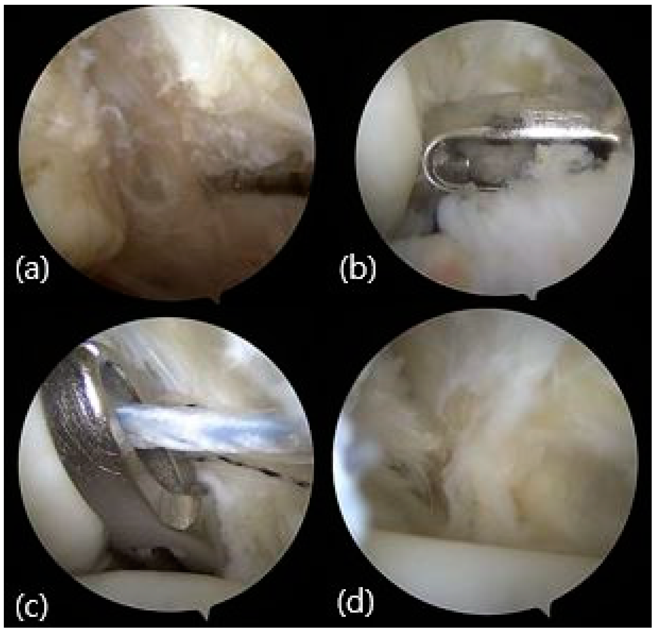 Medicina 60 00921 g001