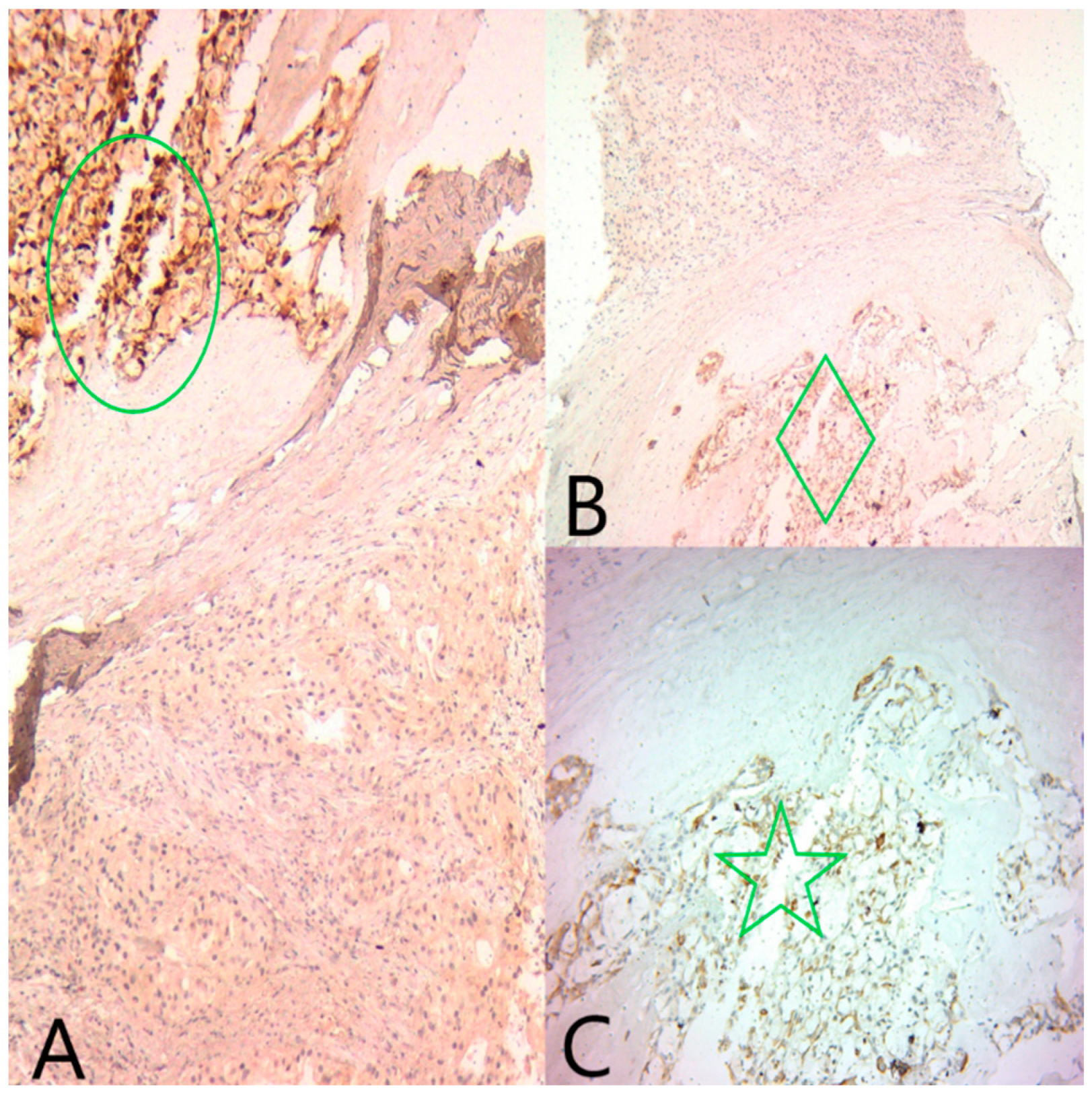 Medicina 60 00924 g005