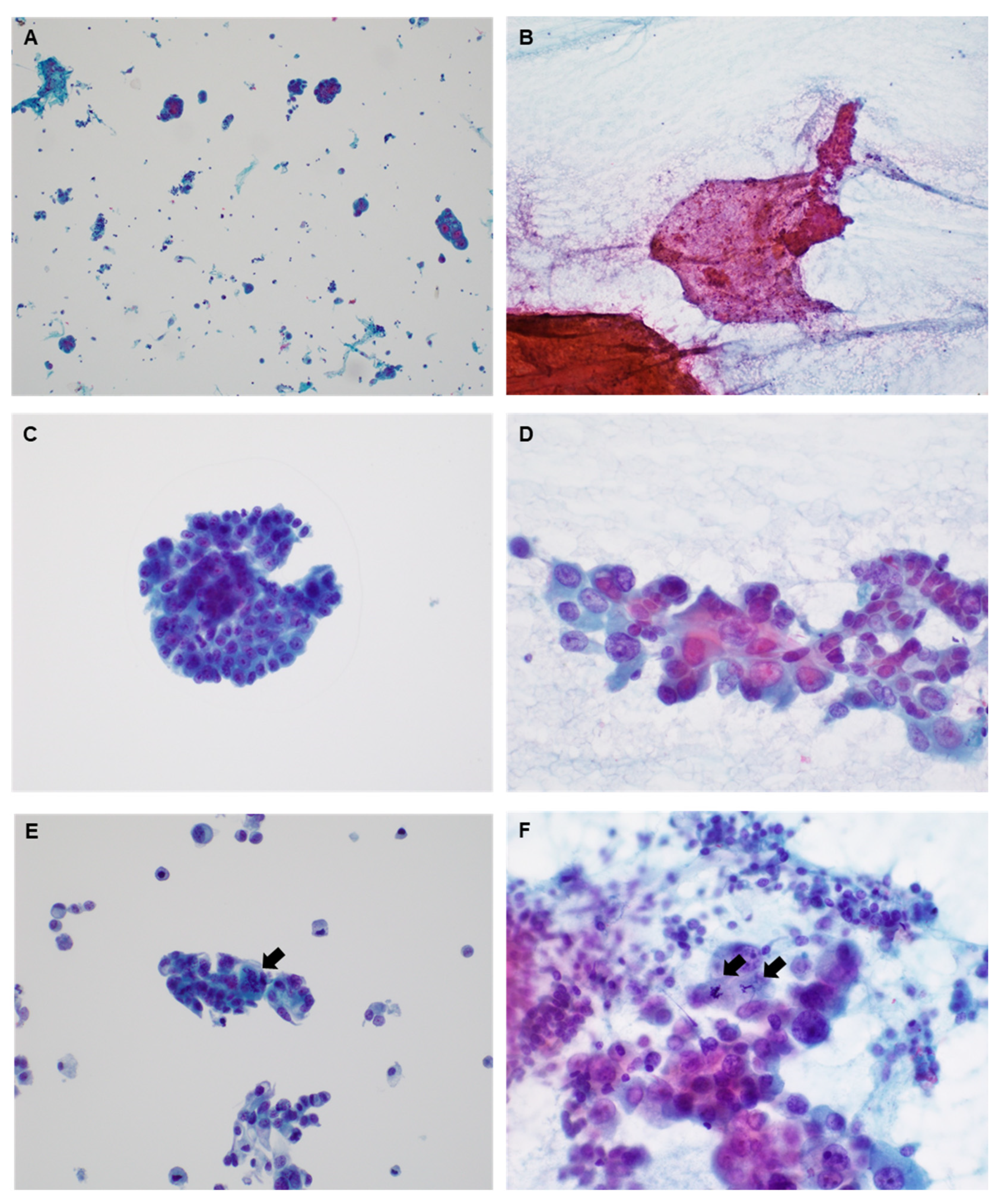 Medicina 60 00930 g001