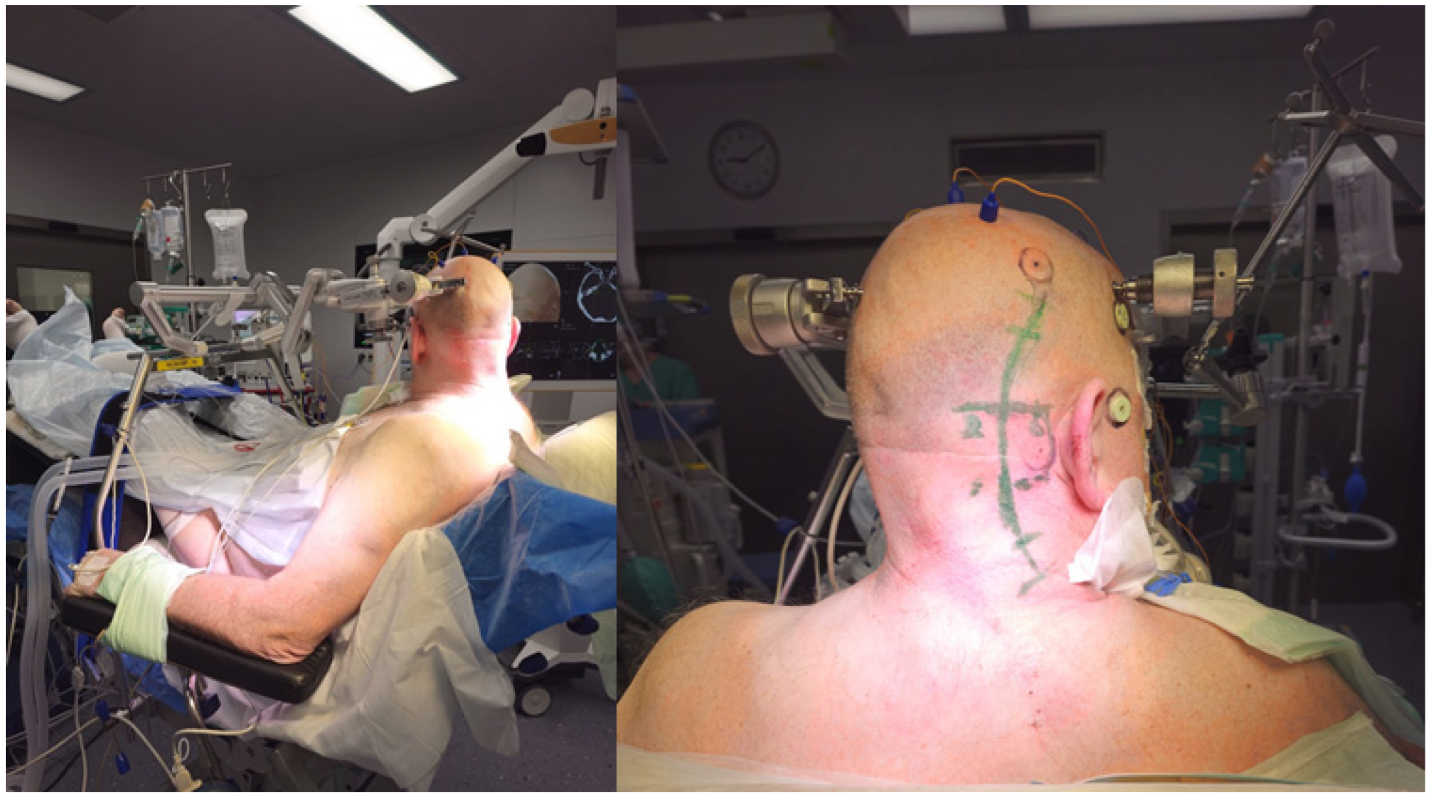 Medicina 60 00932 g001