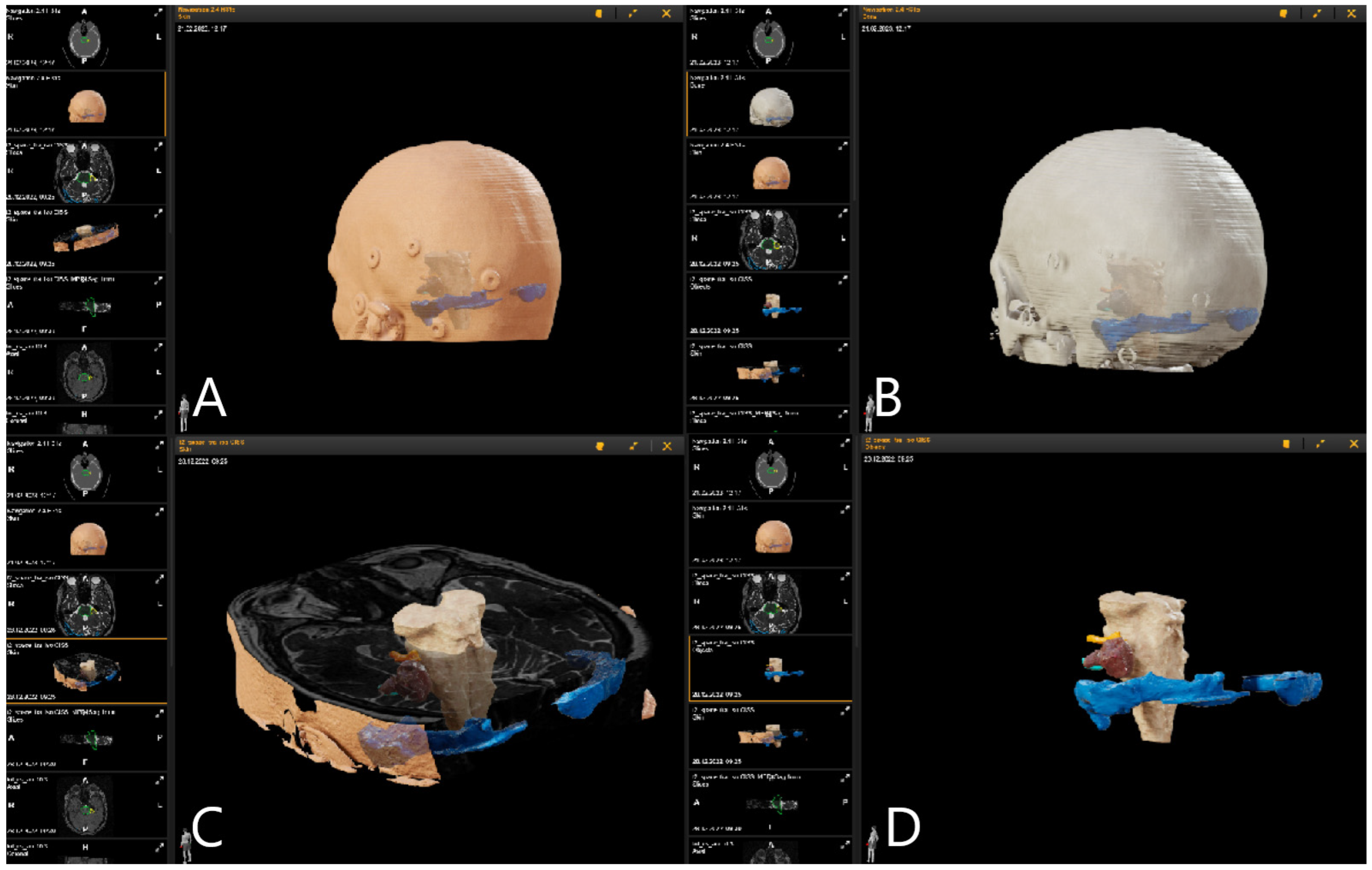 Medicina 60 00932 g003