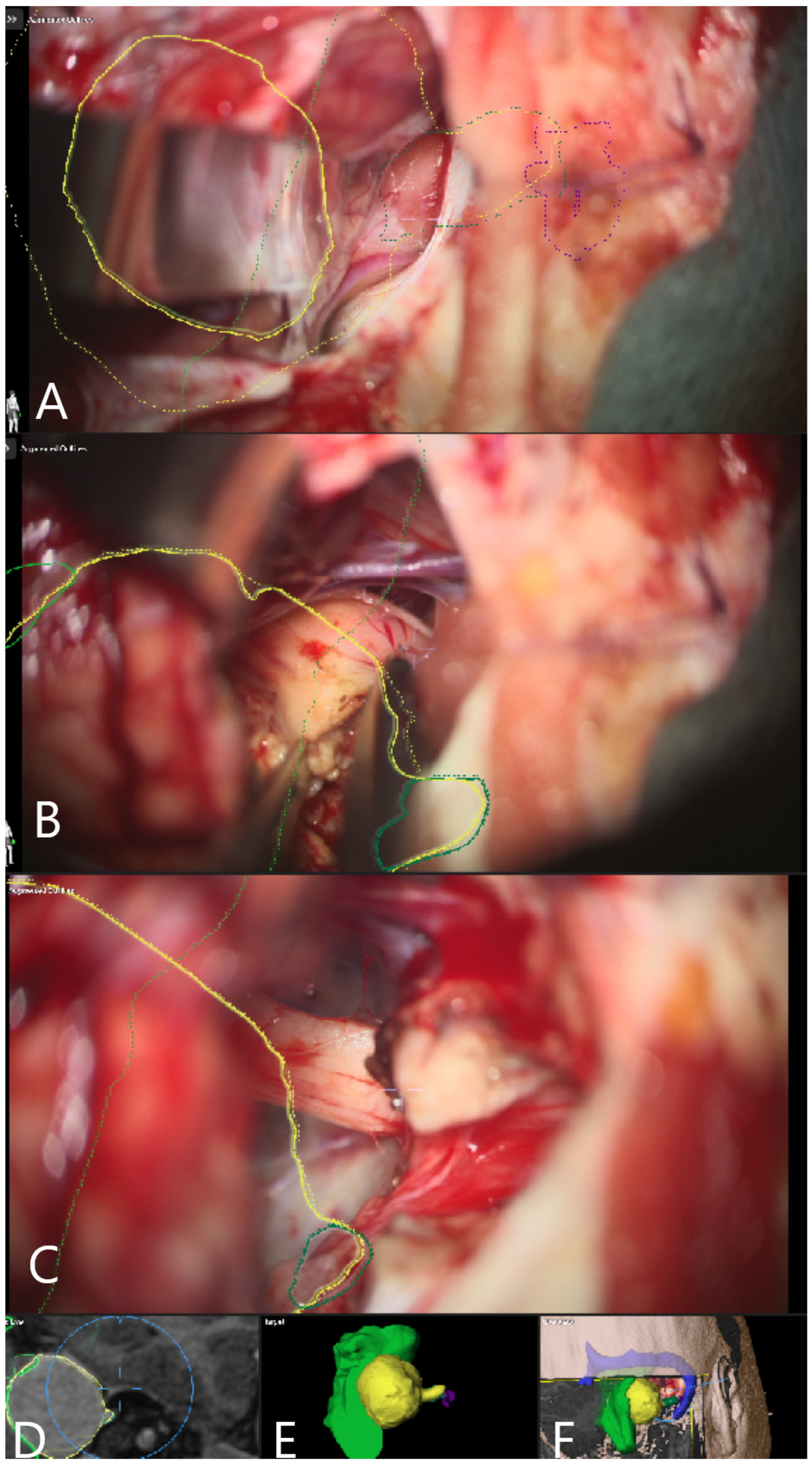Medicina 60 00932 g005