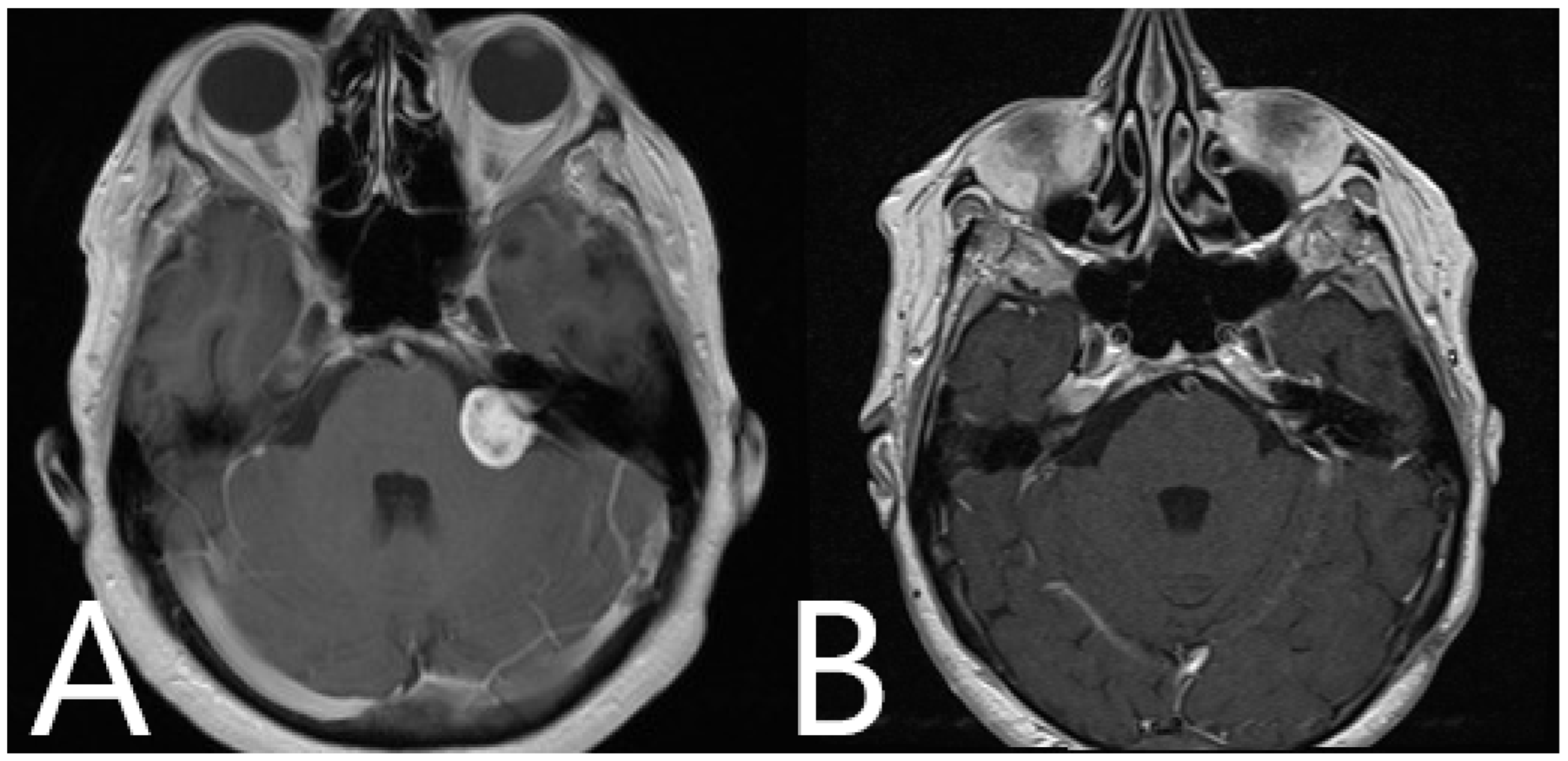 Medicina 60 00932 g011
