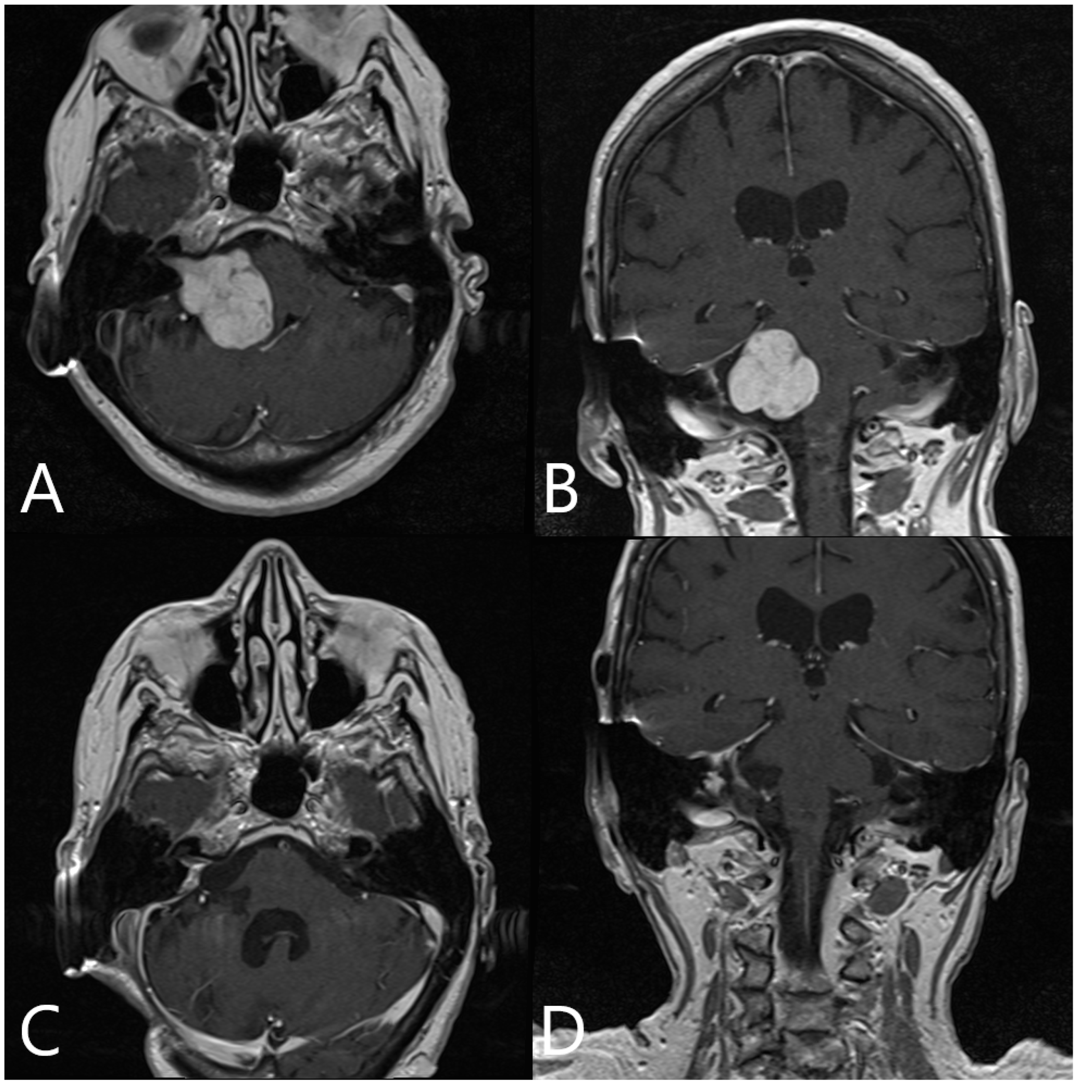 Medicina 60 00932 g014