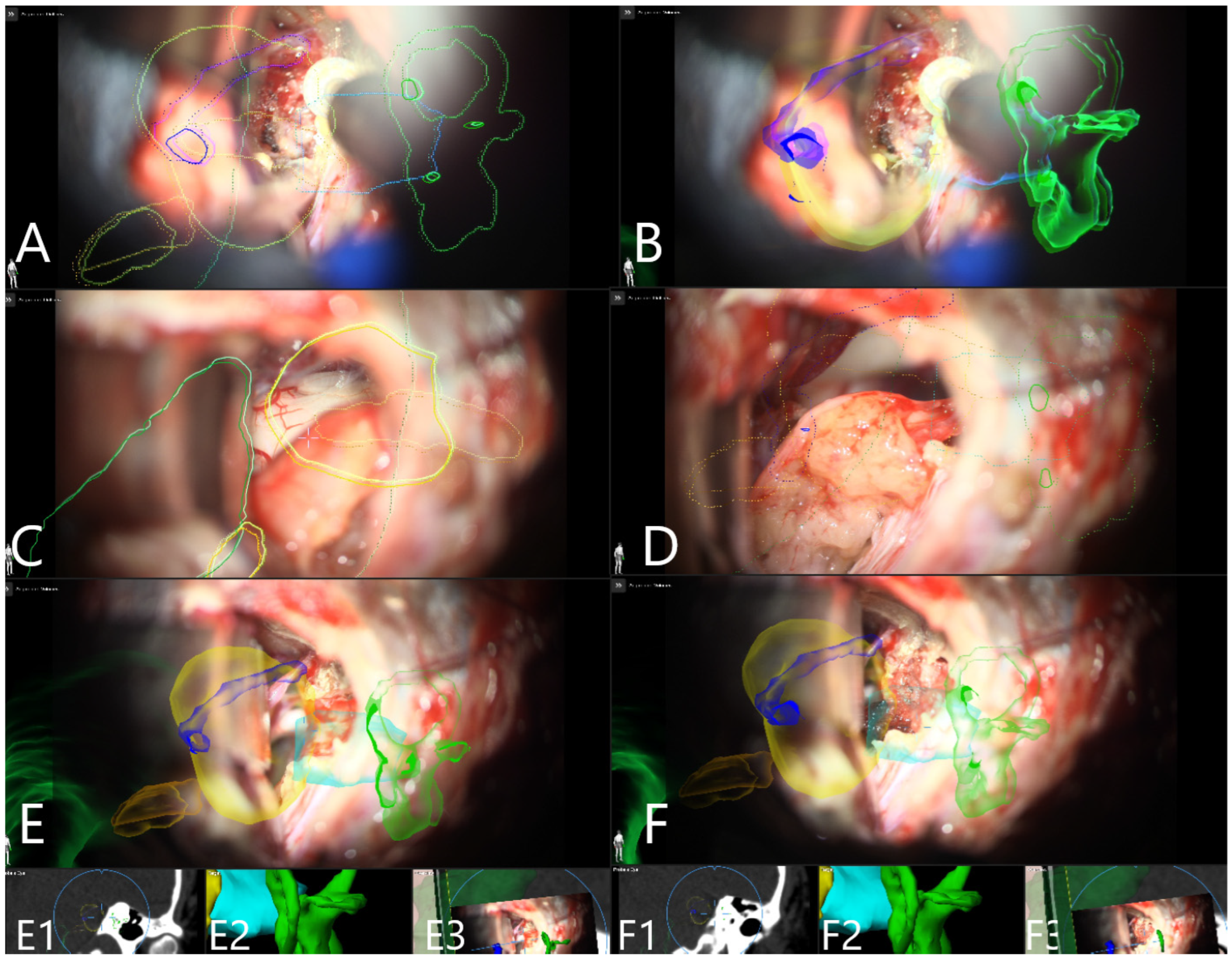 Medicina 60 00932 g017