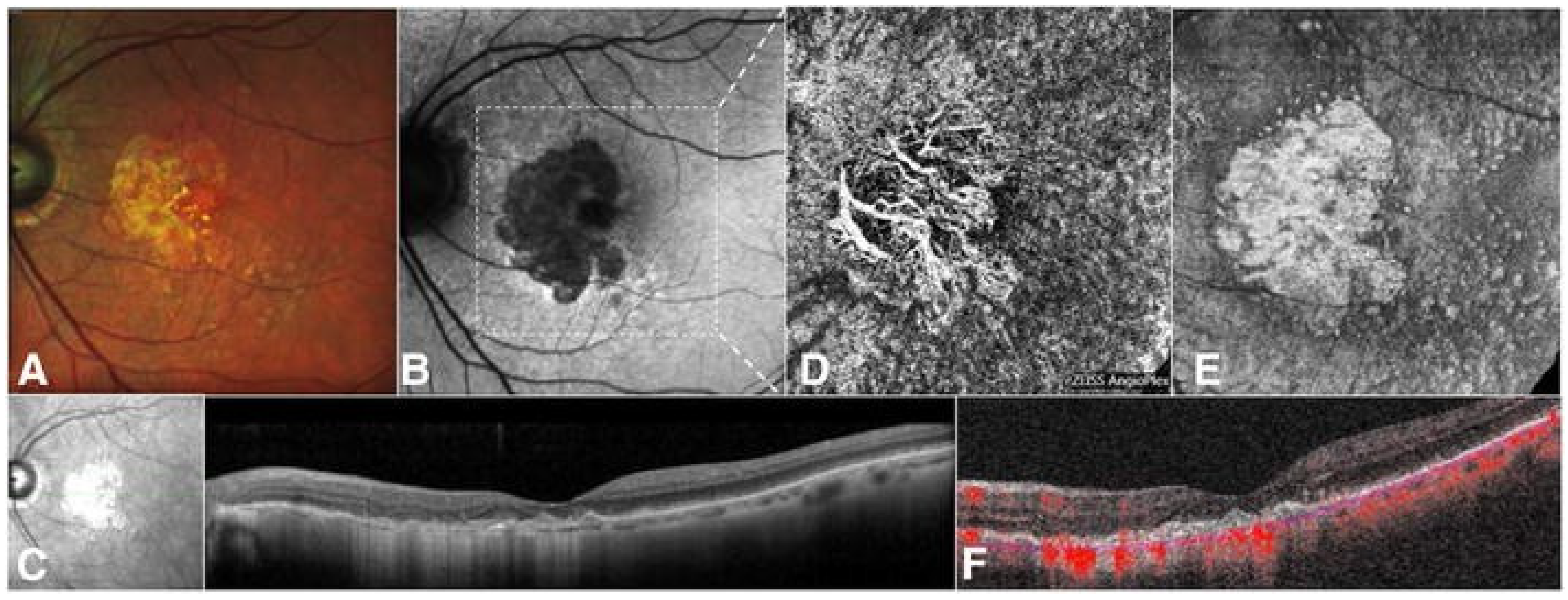 Medicina 60 00945 g005