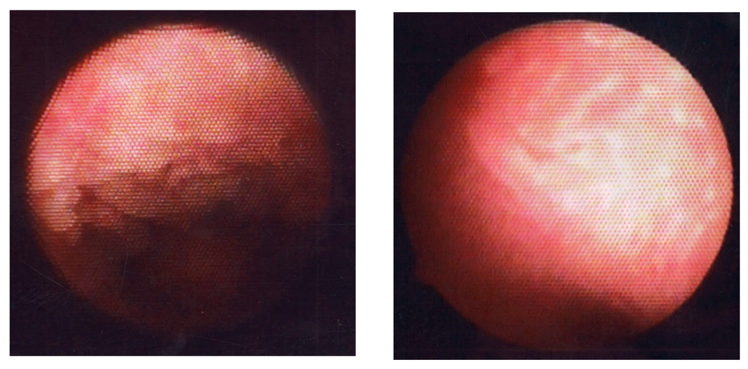 Medicina 60 00972 g006