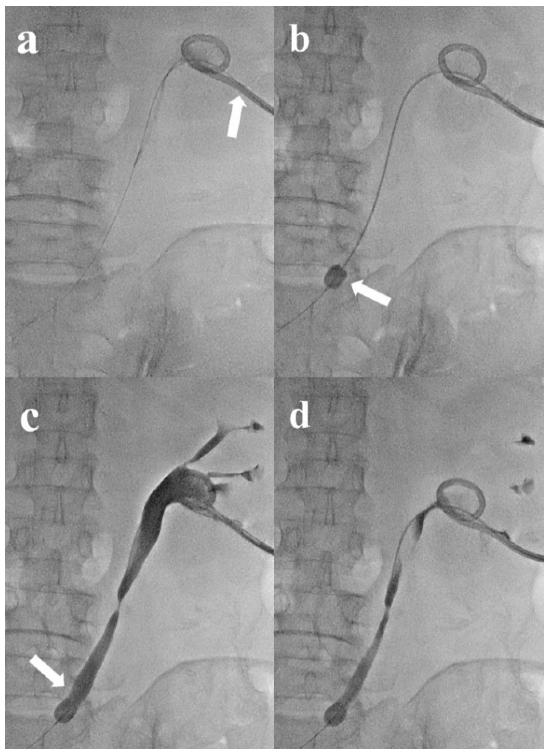 Medicina 60 00975 g002