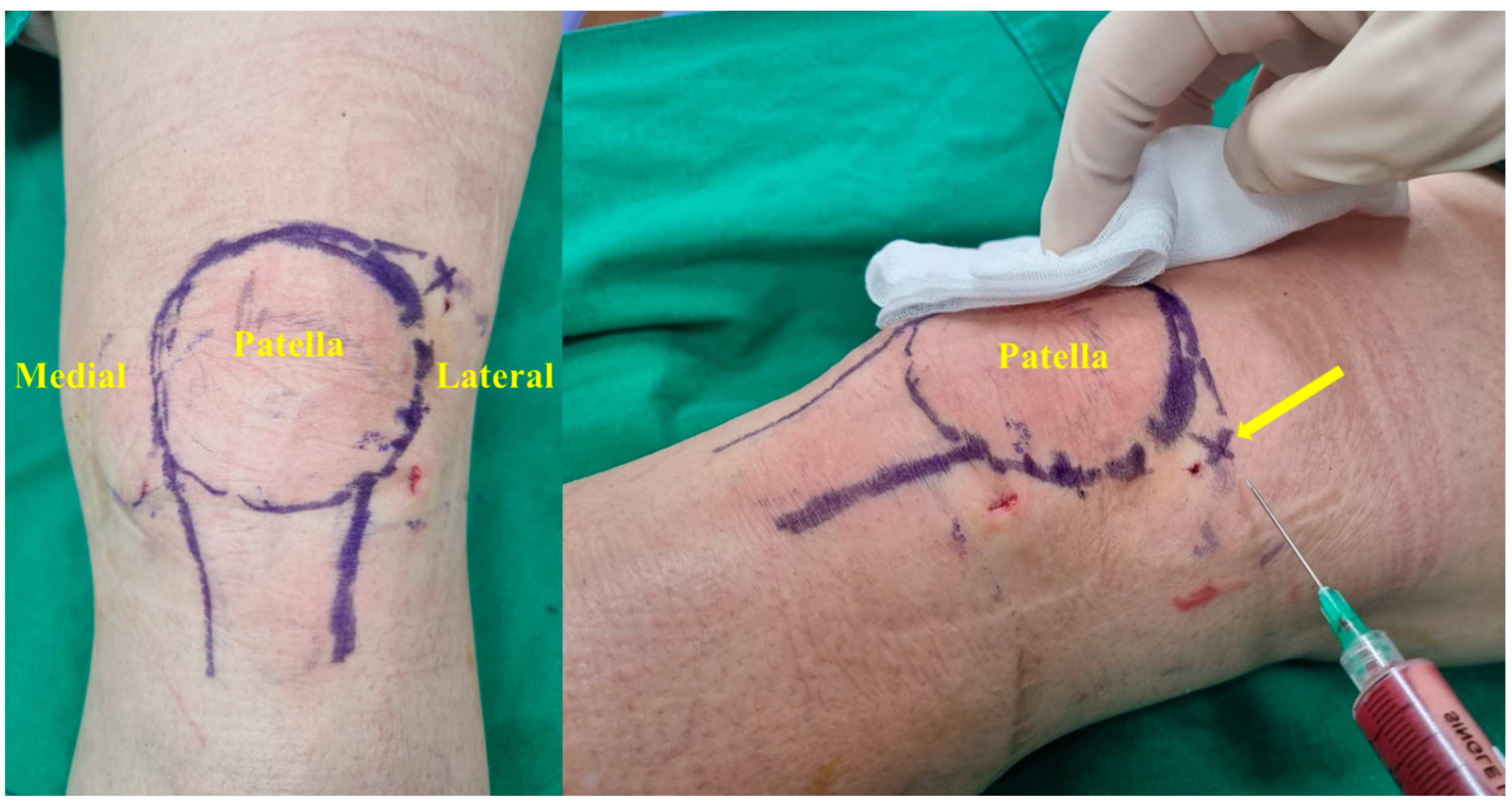 Medicina 60 00977 g004