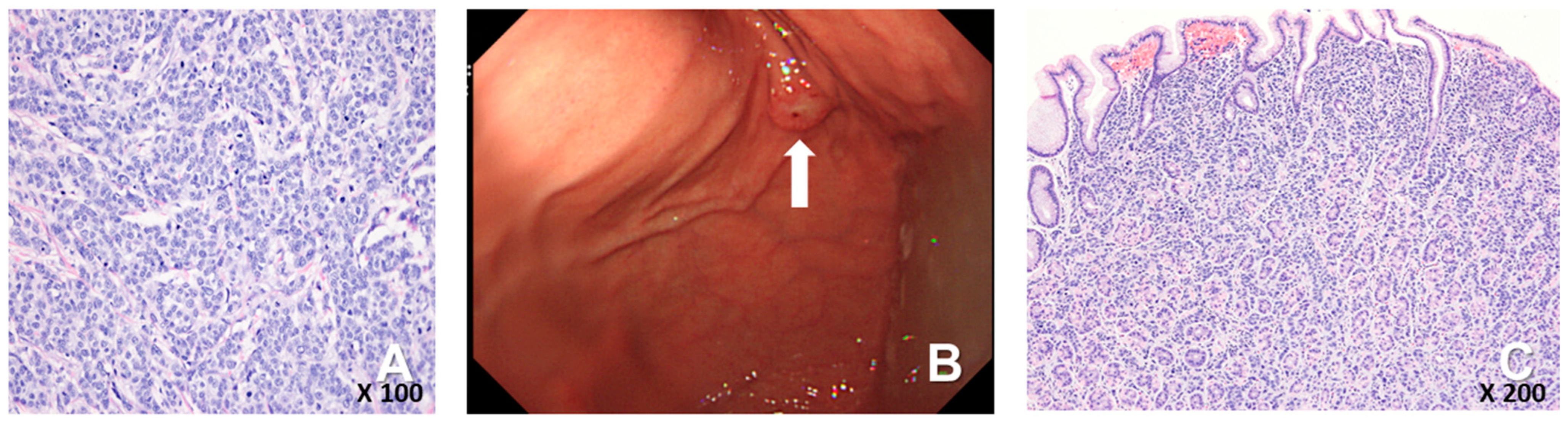 Medicina 60 00980 g001