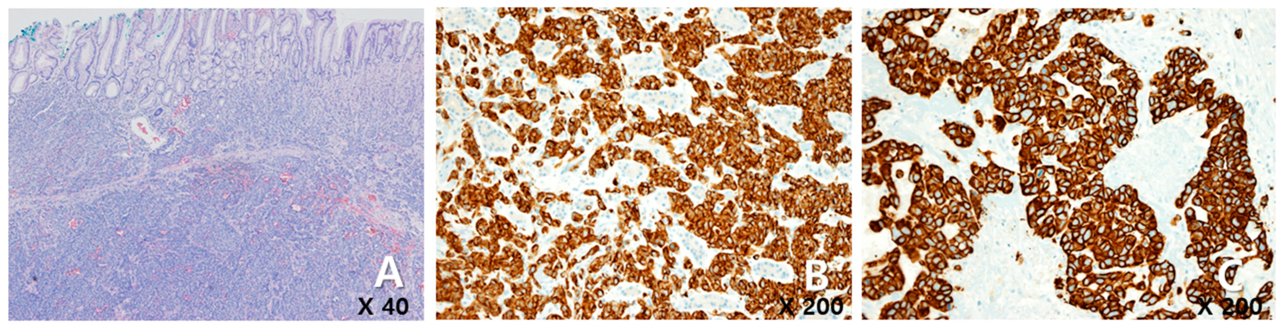 Medicina 60 00980 g003