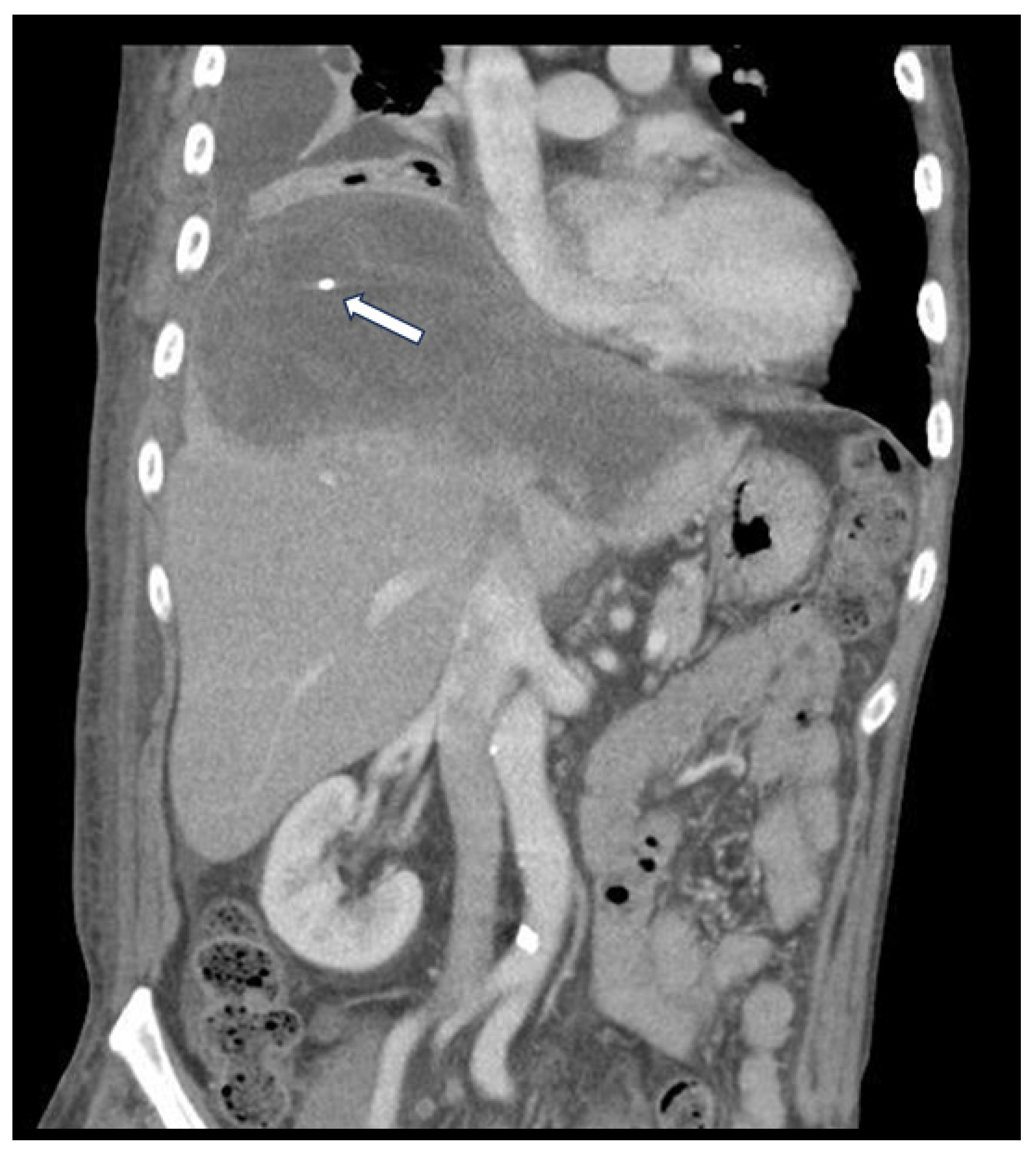Medicina 60 00982 g002