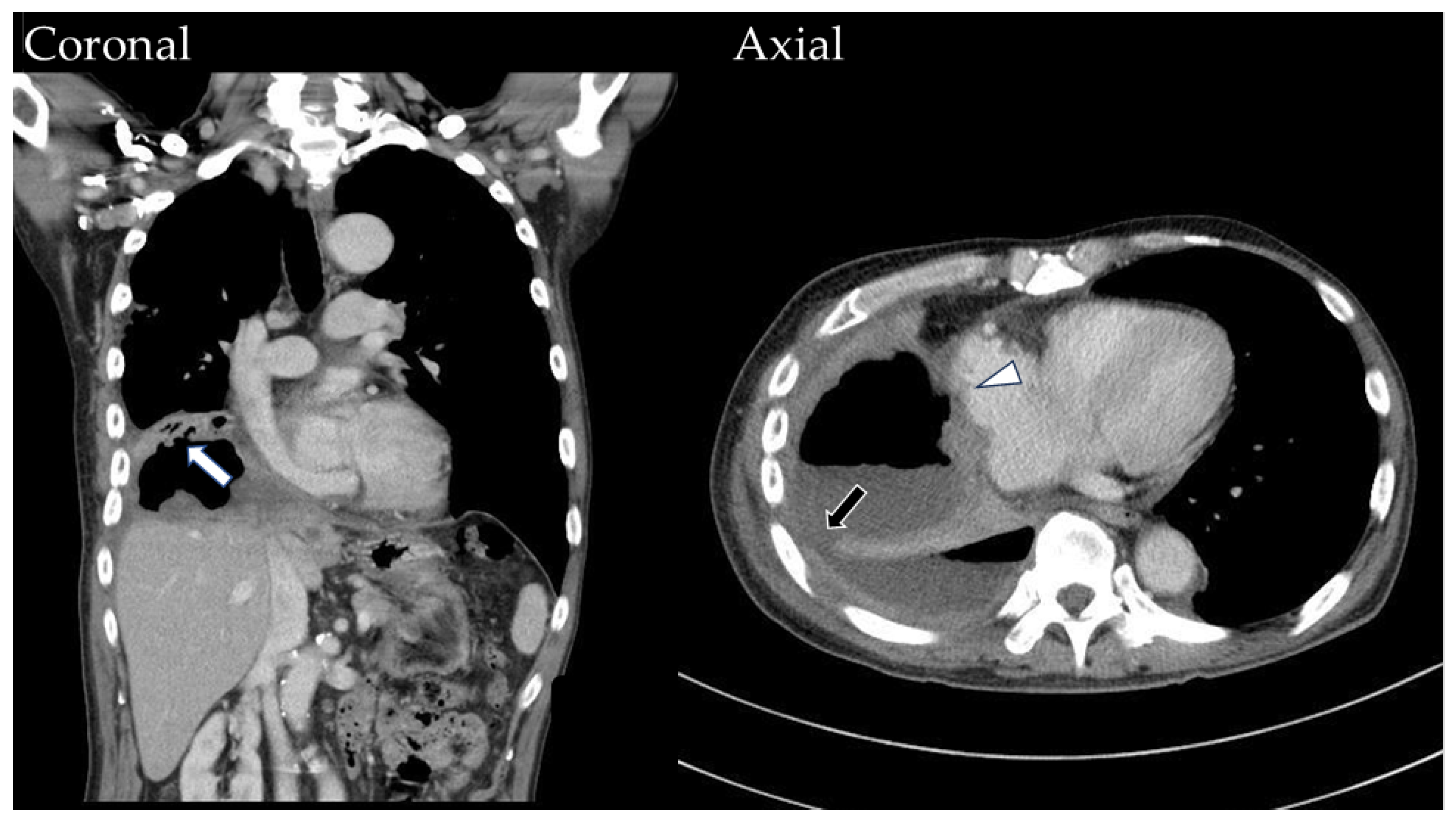 Medicina 60 00982 g003