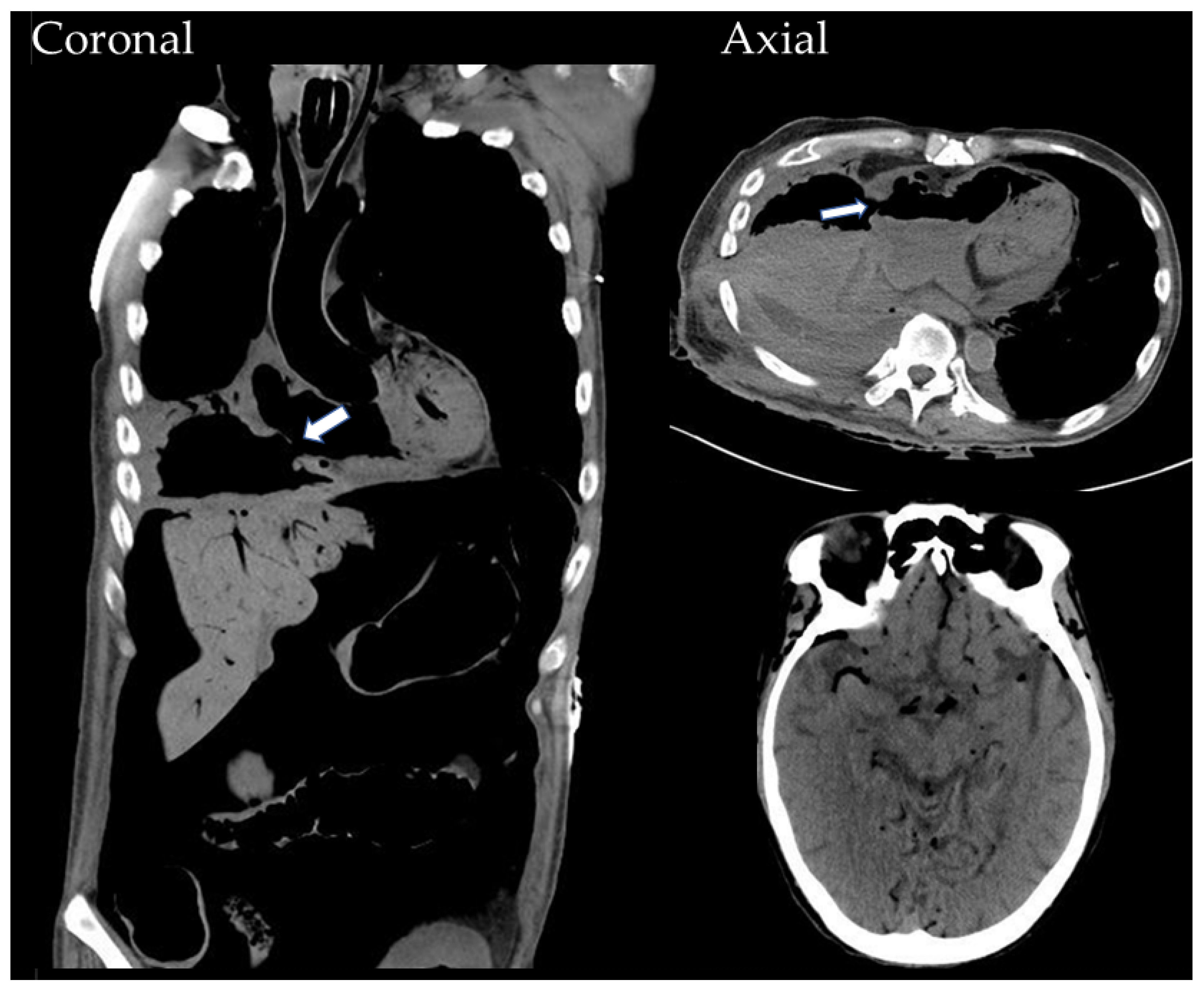 Medicina 60 00982 g004