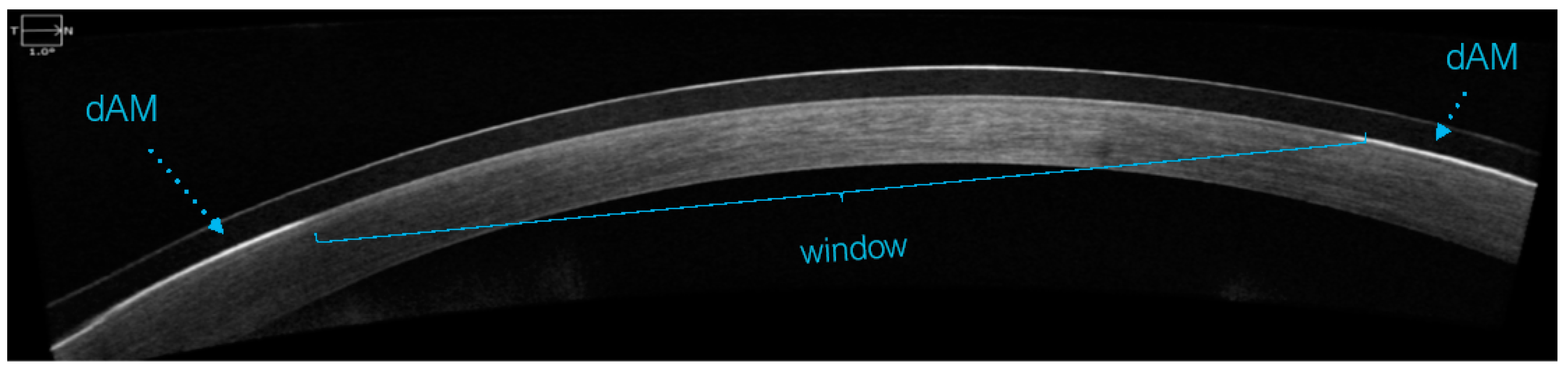 Medicina 60 00985 g004