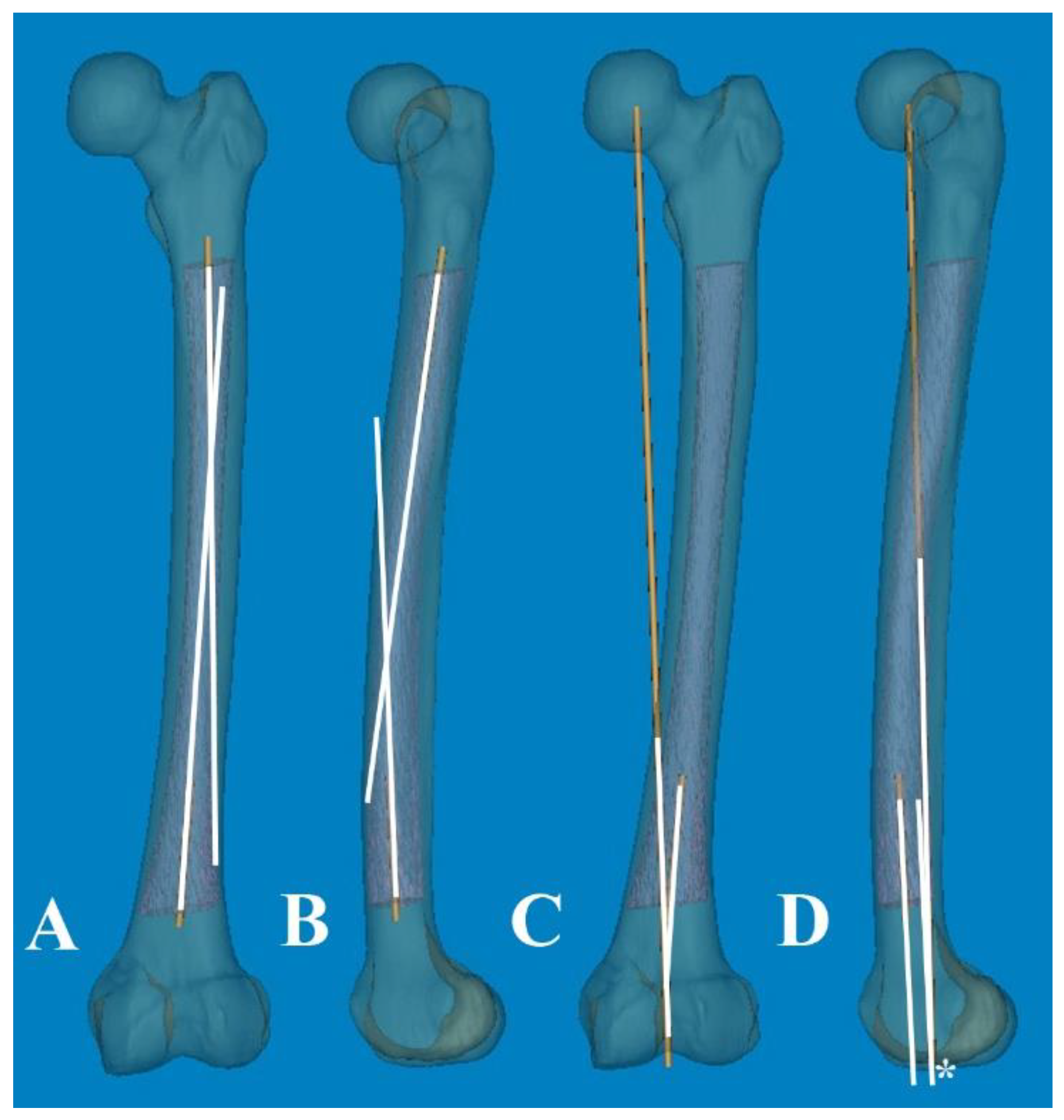 Medicina 60 00986 g002