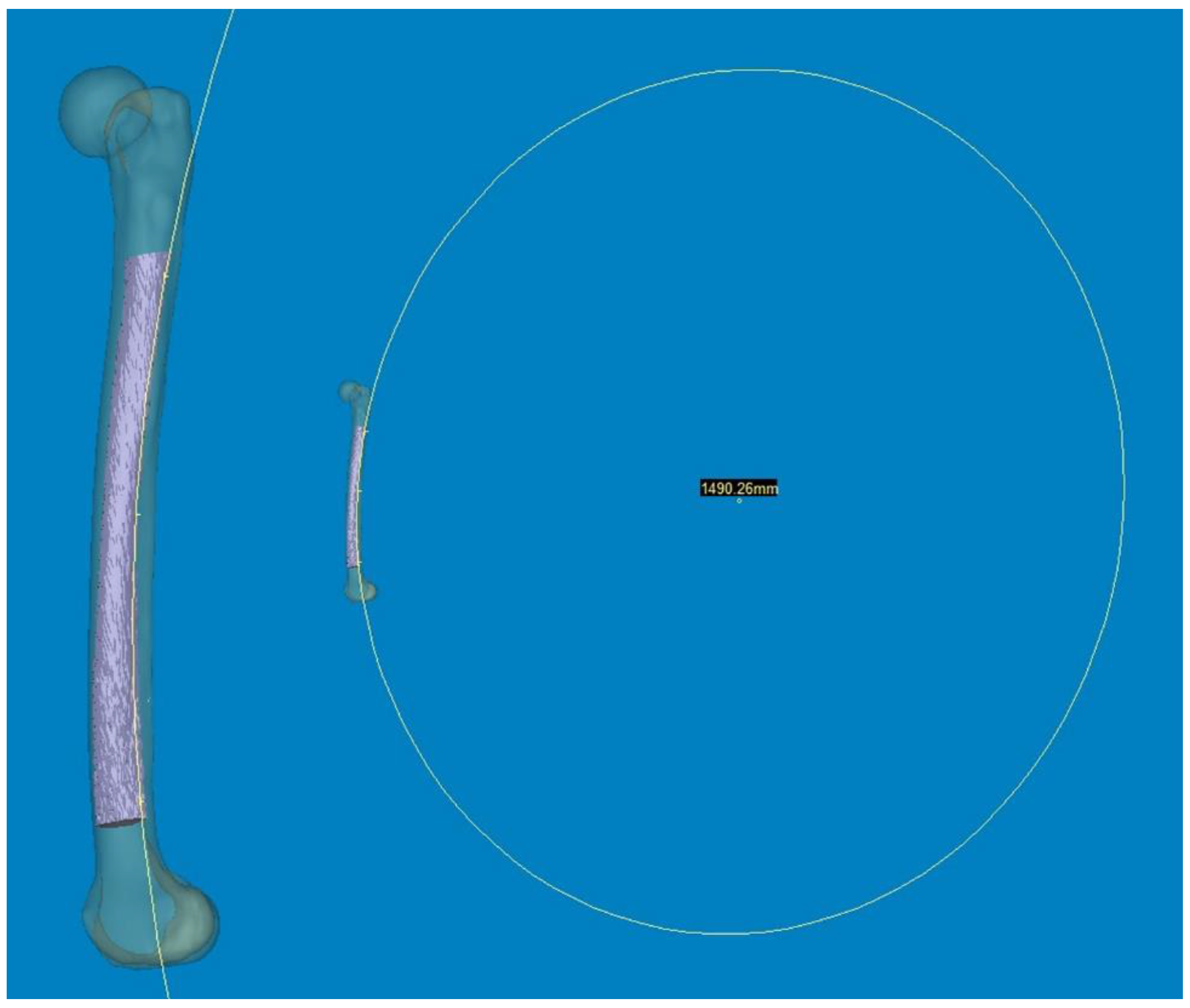 Medicina 60 00986 g003