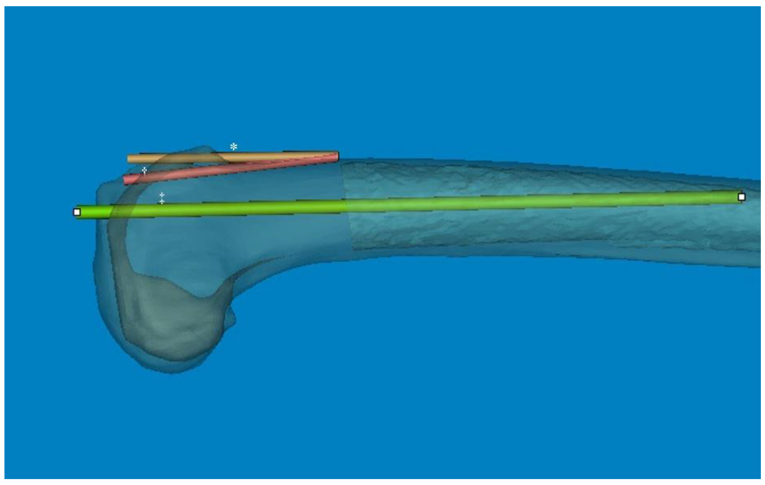 Medicina 60 00986 g004