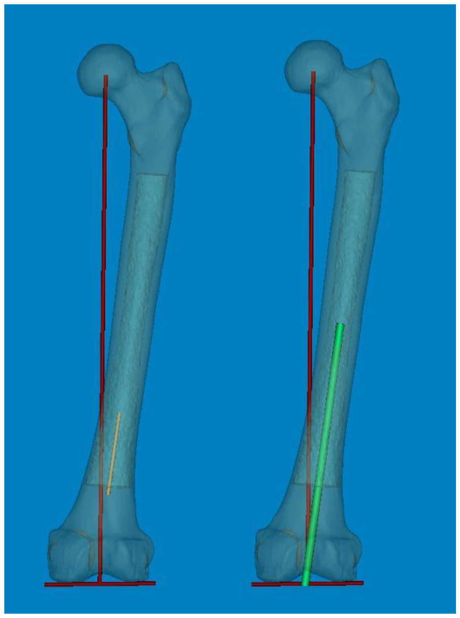Medicina 60 00986 g005