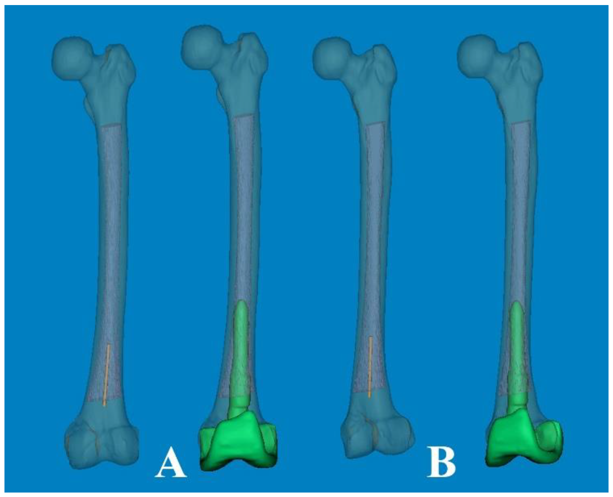 Medicina 60 00986 g006