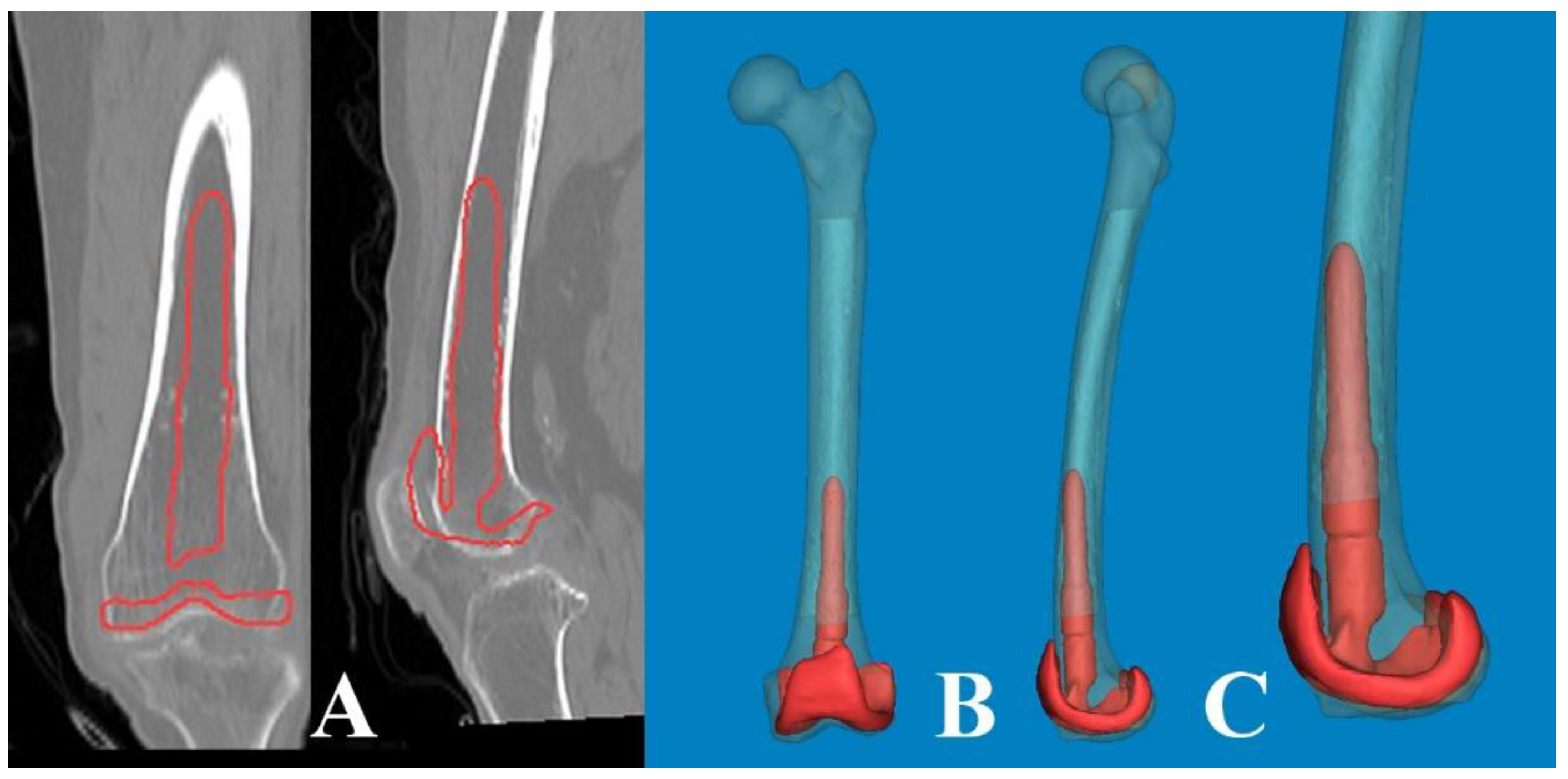 Medicina 60 00986 g007