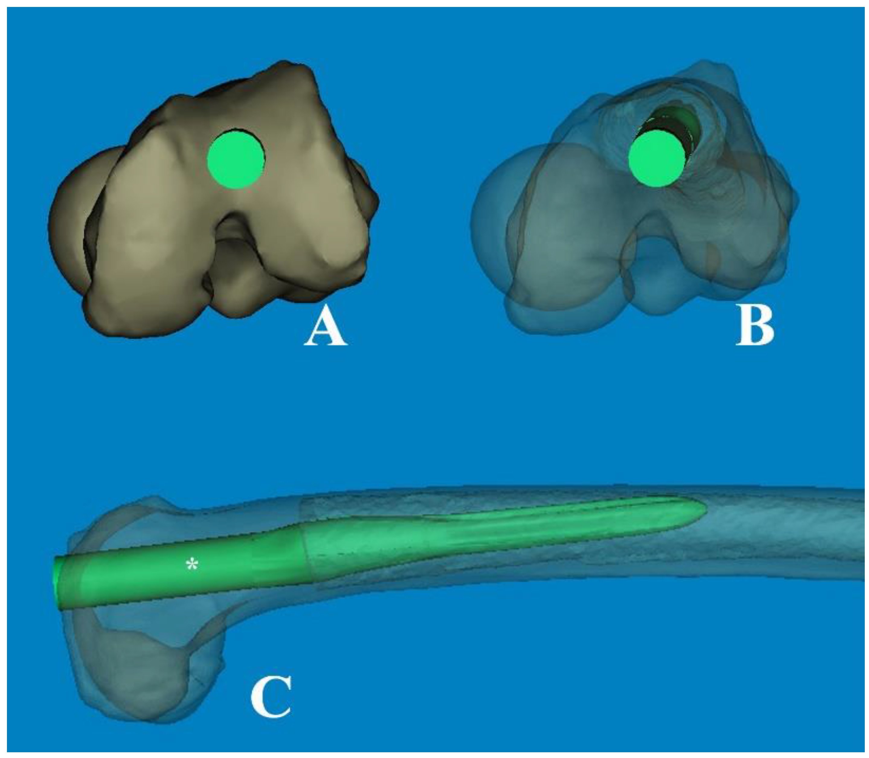 Medicina 60 00986 g008