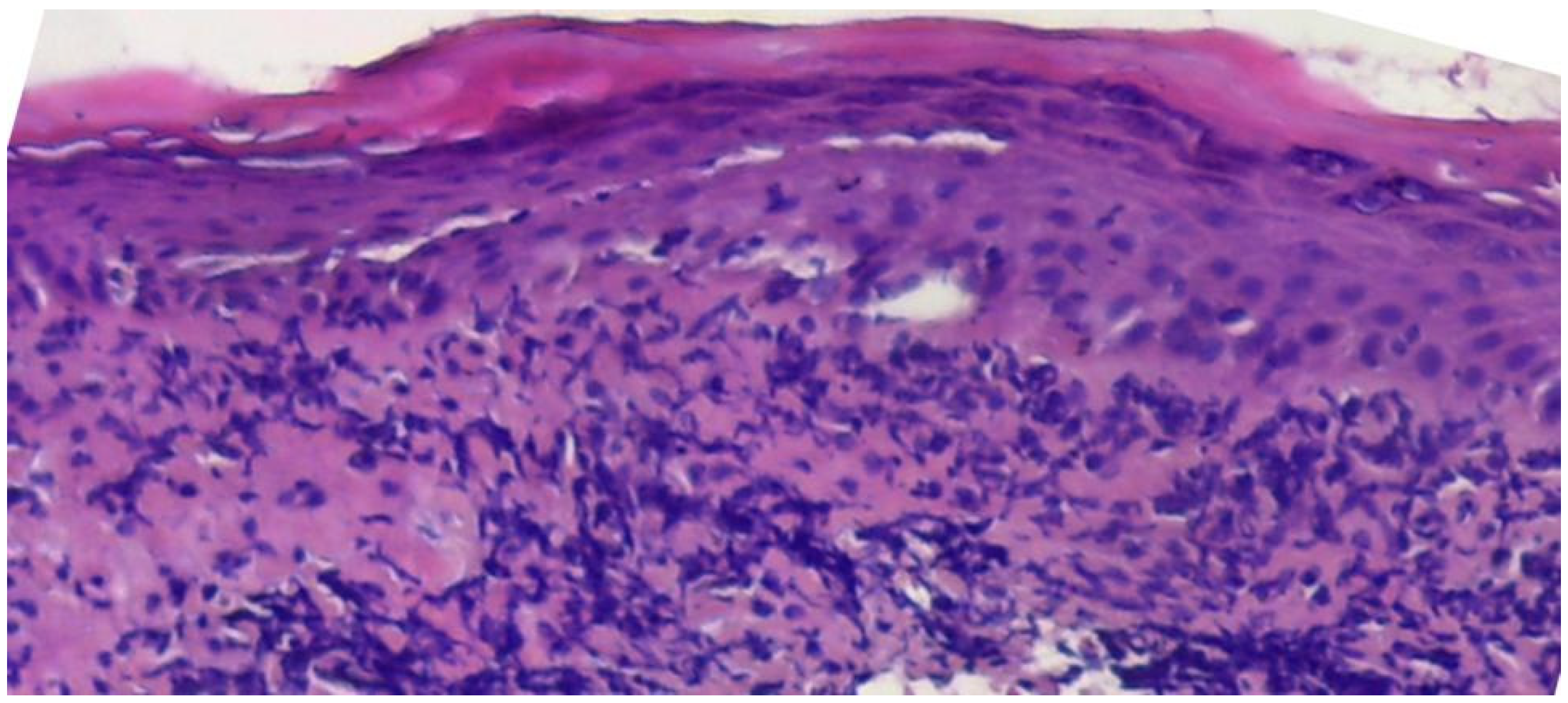 Medicina 60 00987 g003