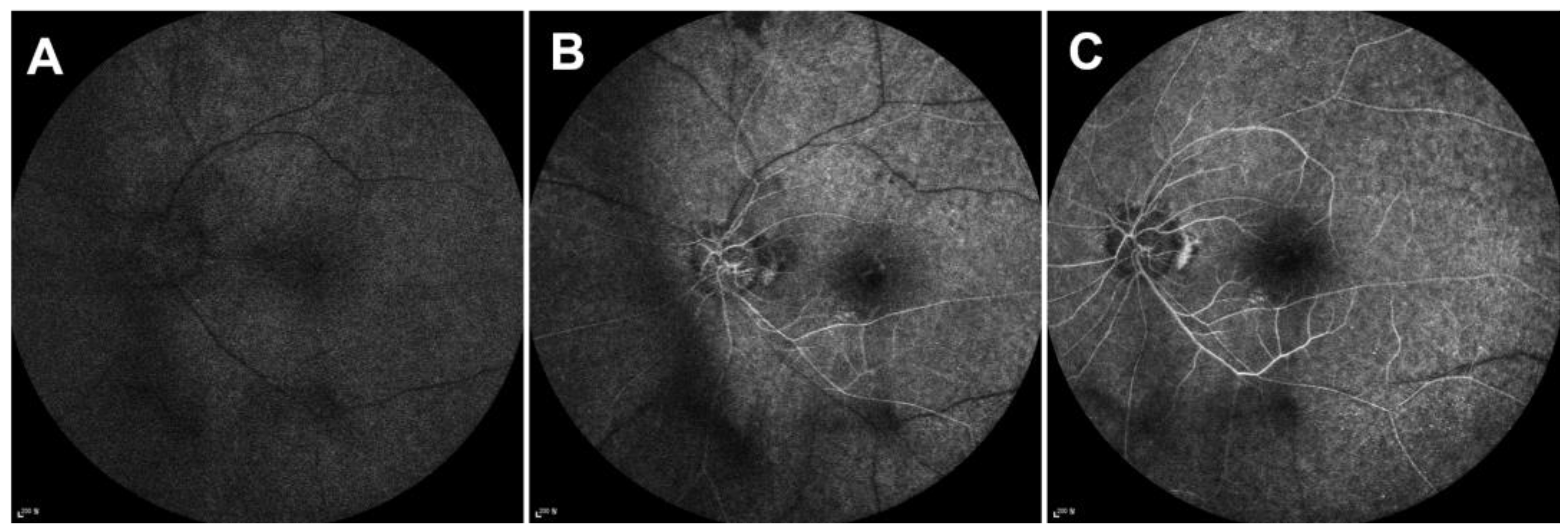 Medicina 60 00992 g003