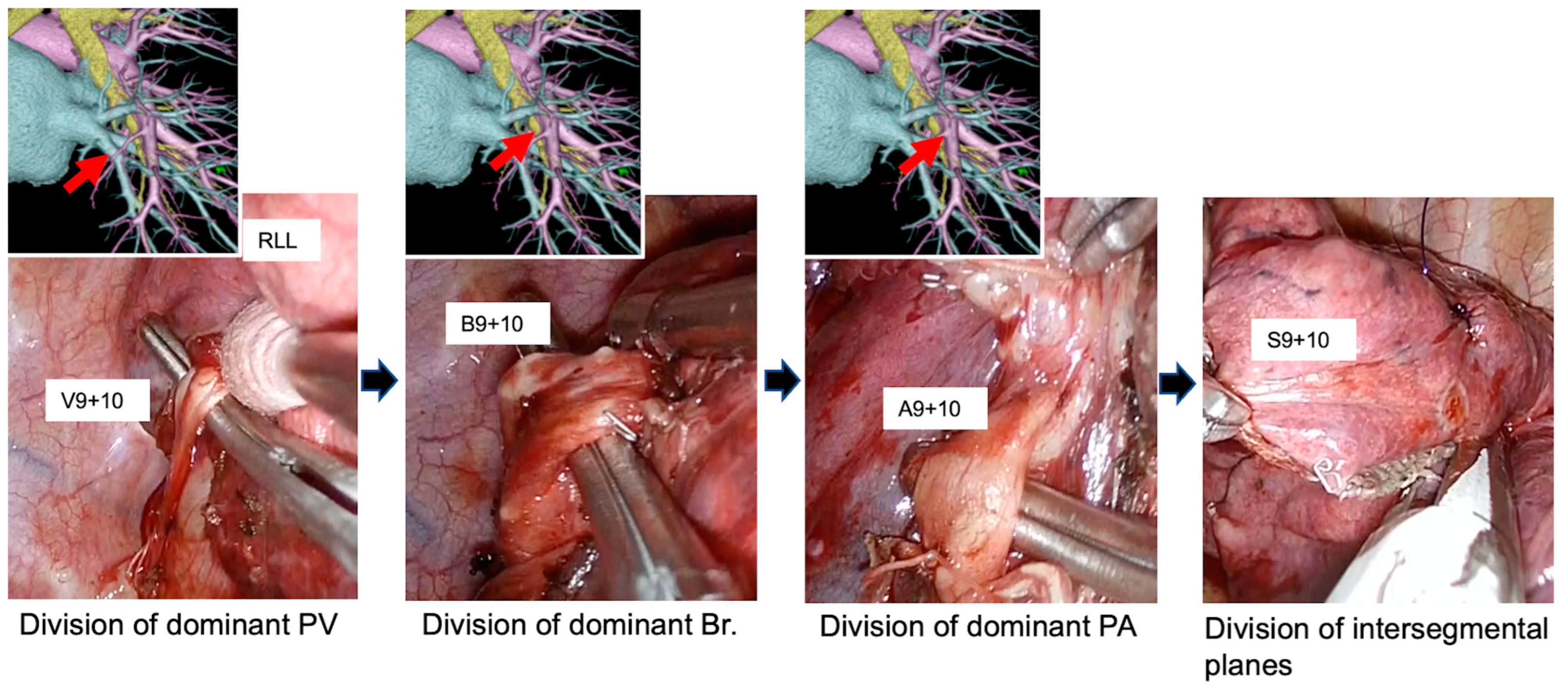 Medicina 60 00994 g002