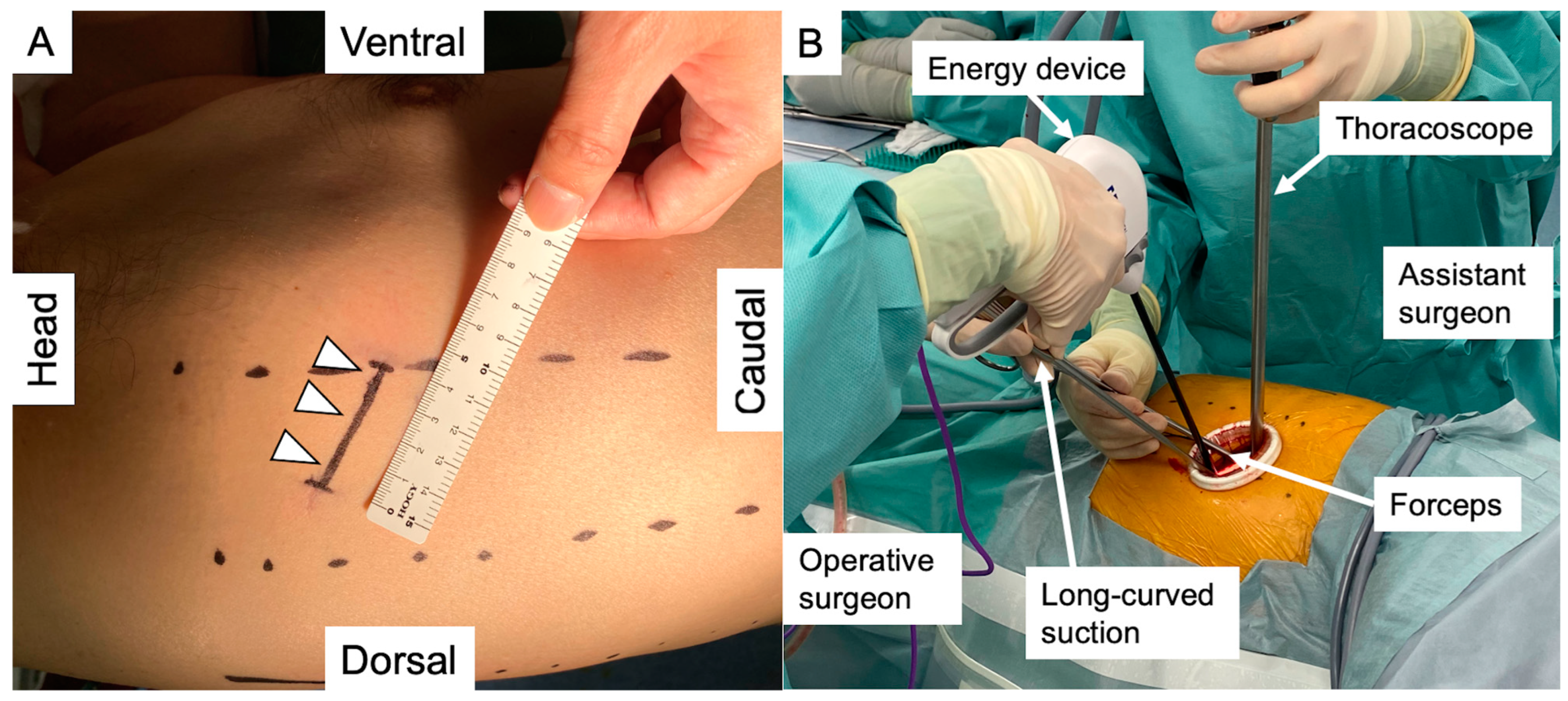 Medicina 60 00994 g003
